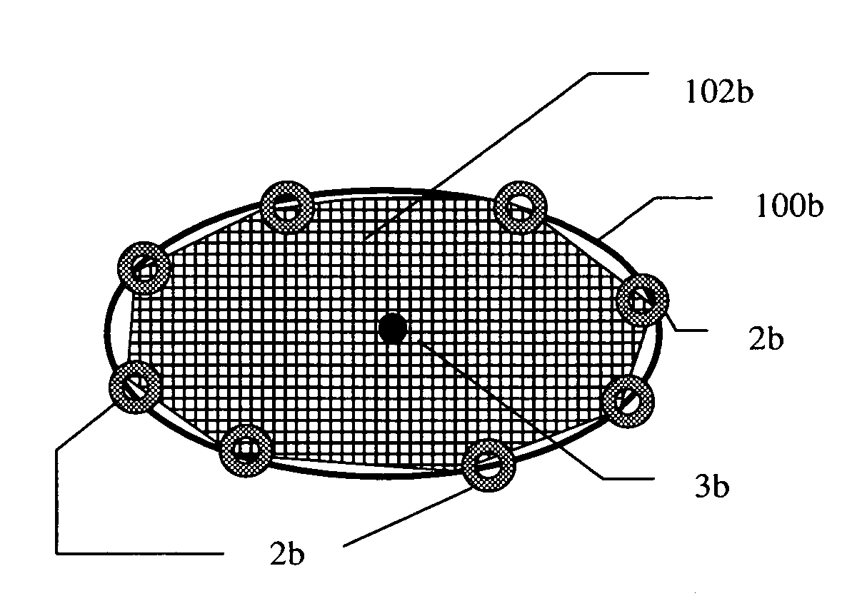 Distal protection filter with improved wall apposition