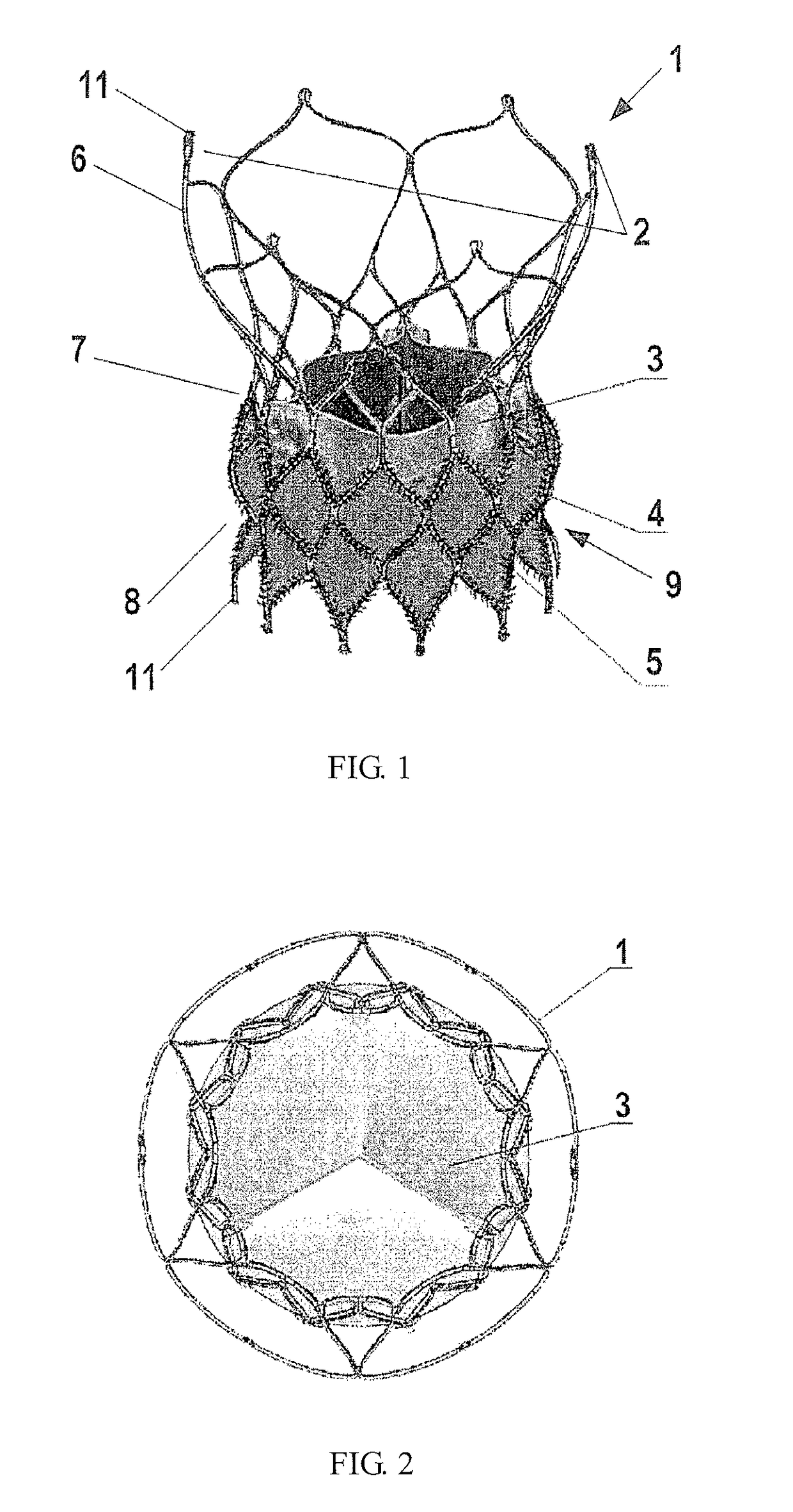 Heart valve prosthesis