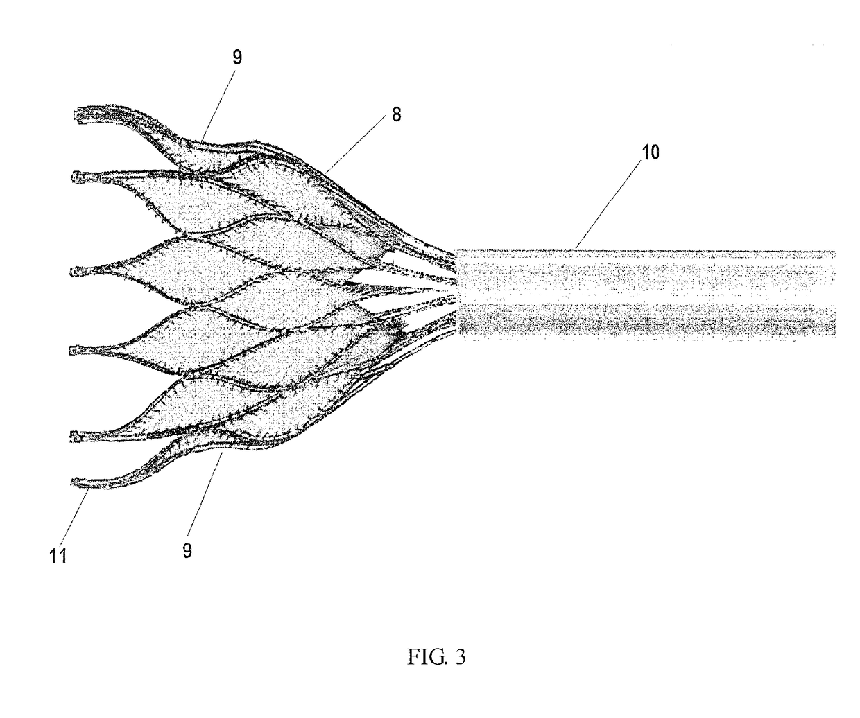 Heart valve prosthesis