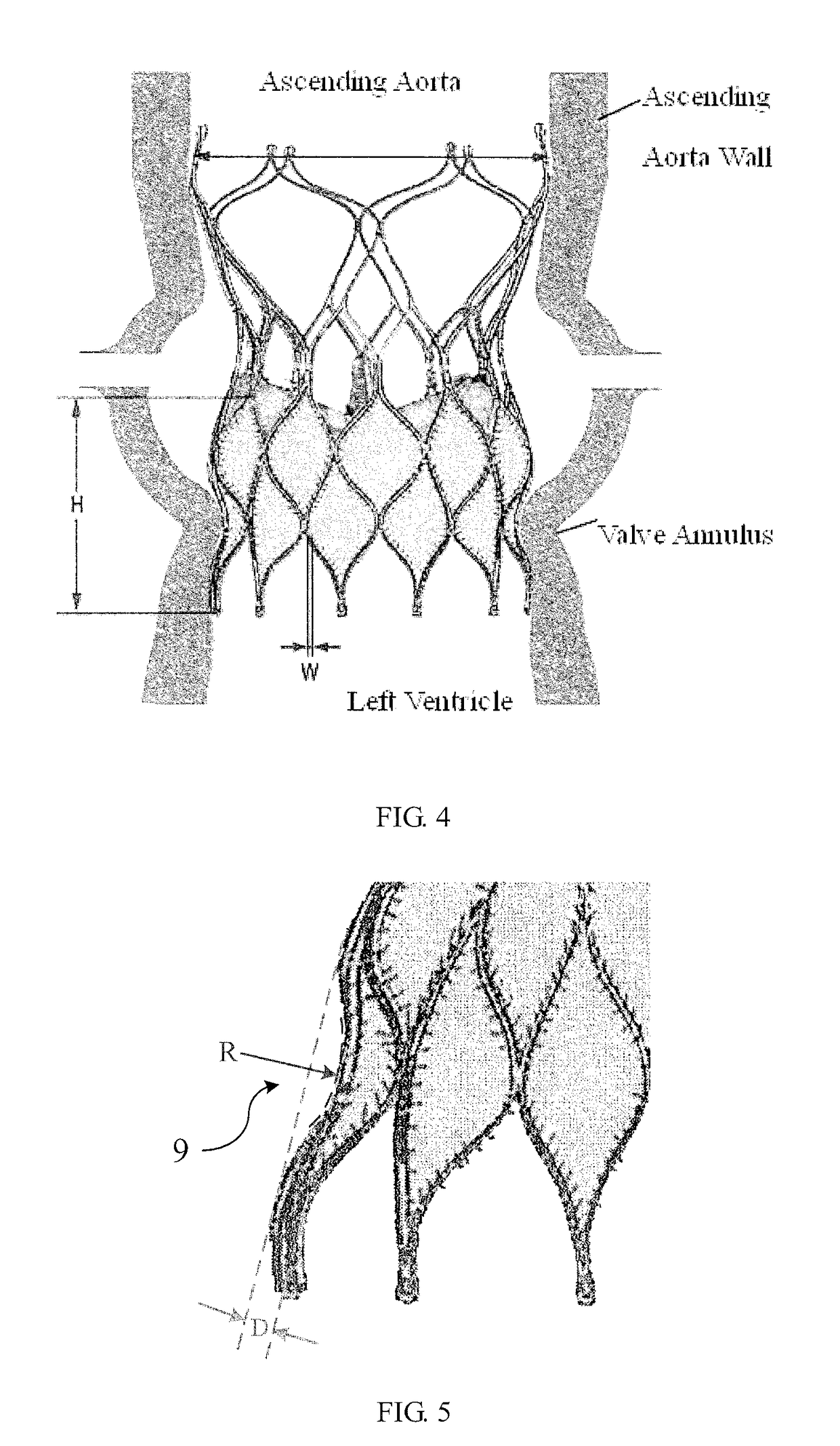 Heart valve prosthesis