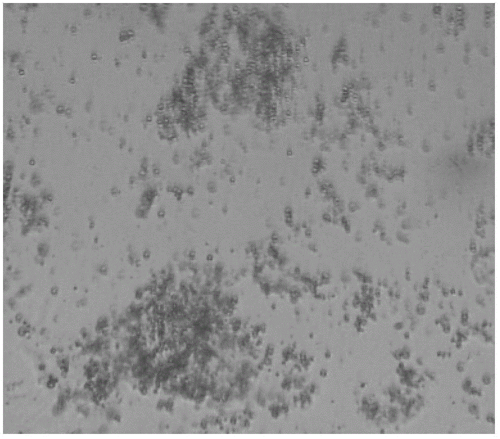 High-content toltrazuril soluble powder, as well as preparation method and application thereof