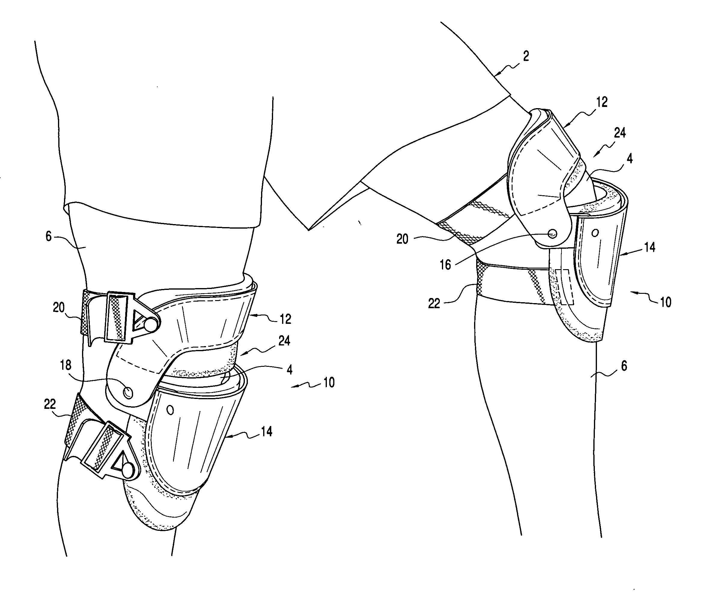 Joint protection device