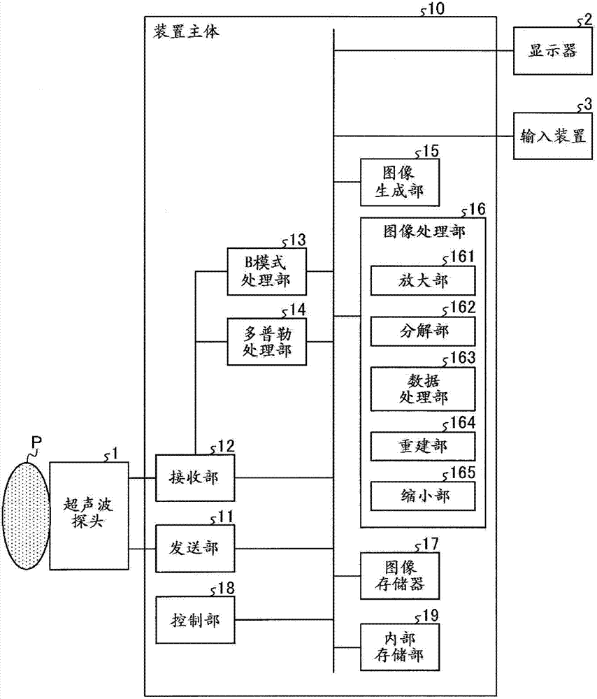 Image-processing equipment and medical diagnostic imaging equipment