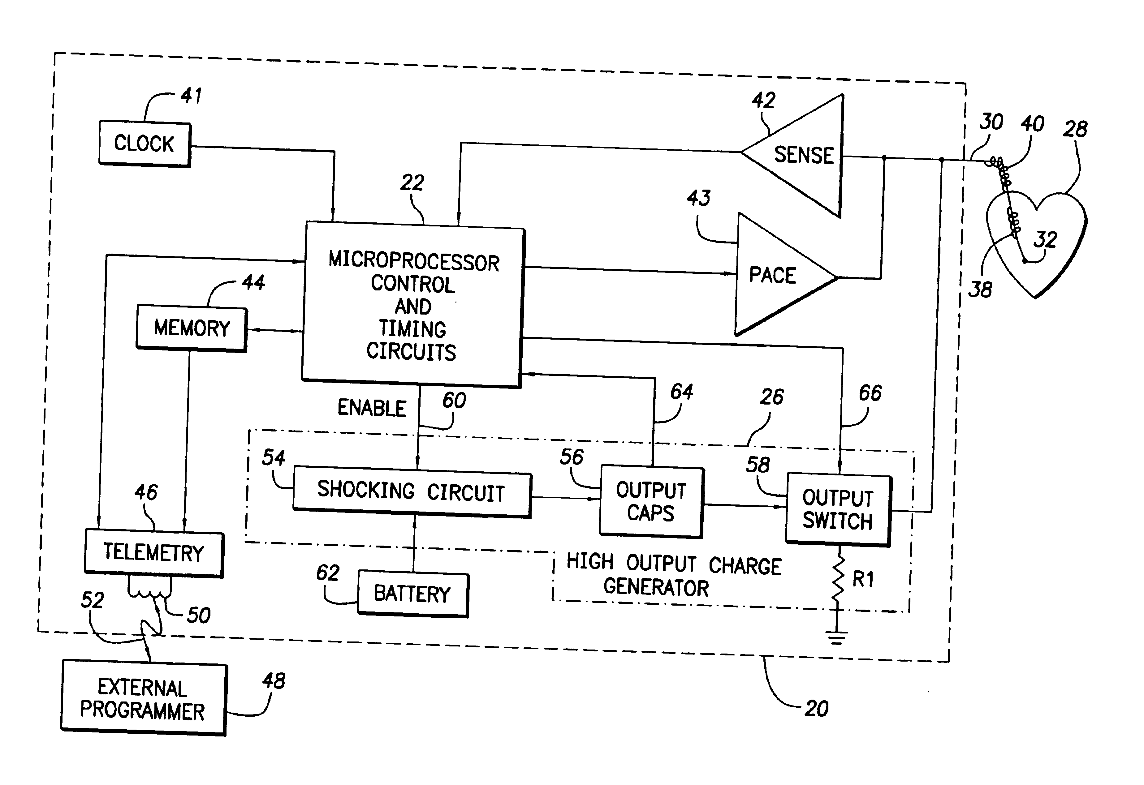 Implantable cardiac device for and method of monitoring progression or regression of heart disease by quantifying morphological features