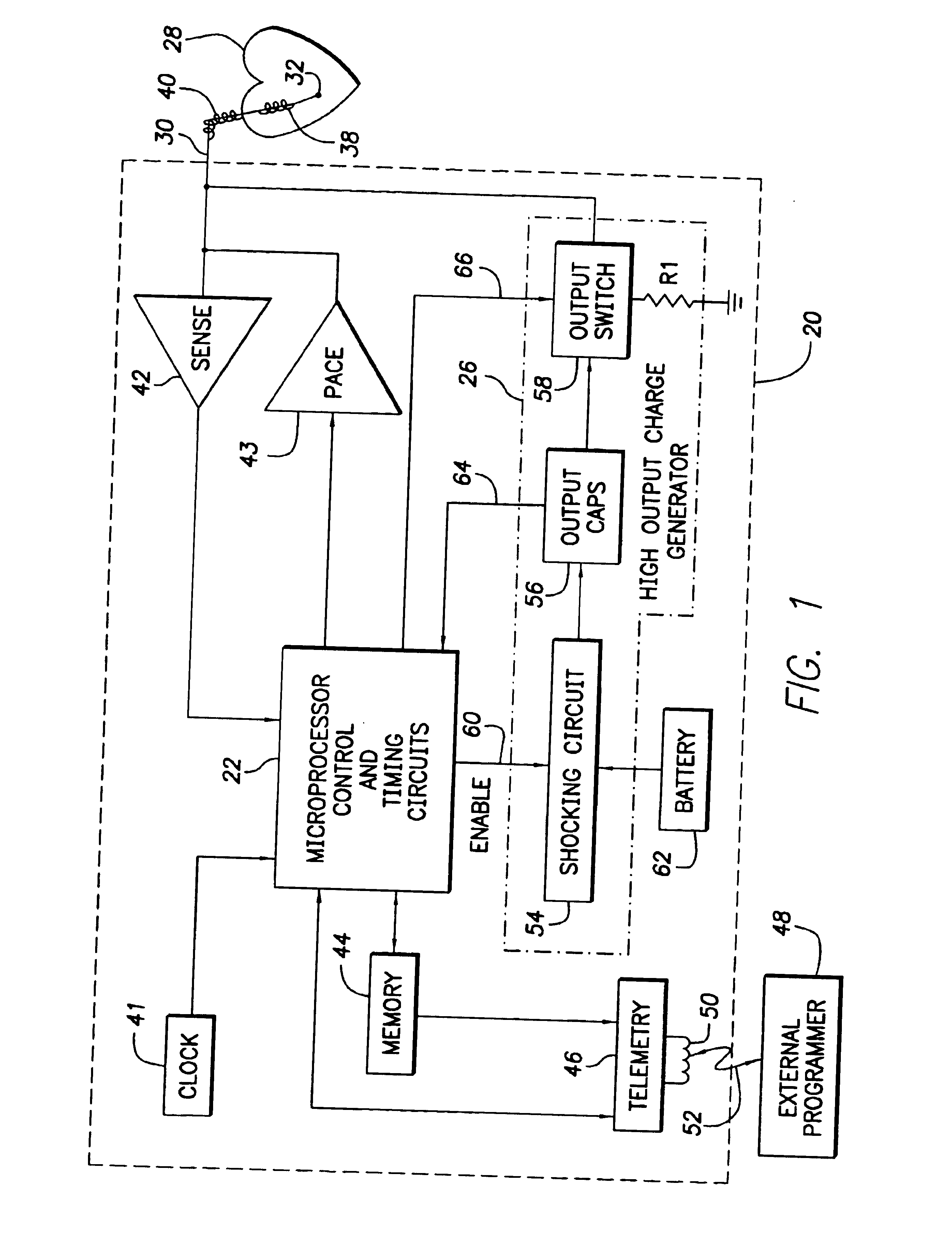 Implantable cardiac device for and method of monitoring progression or regression of heart disease by quantifying morphological features