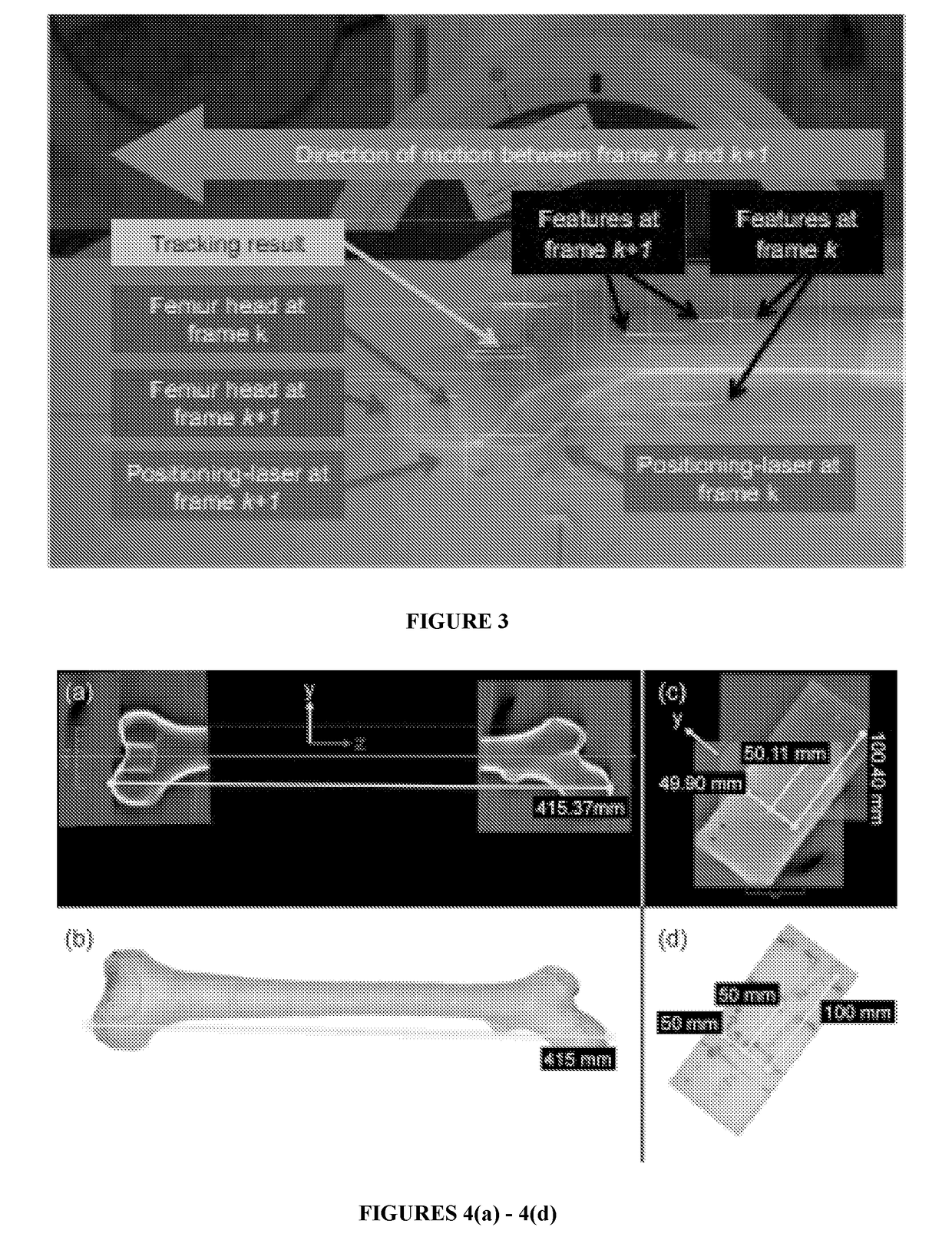 System and method for medical imaging