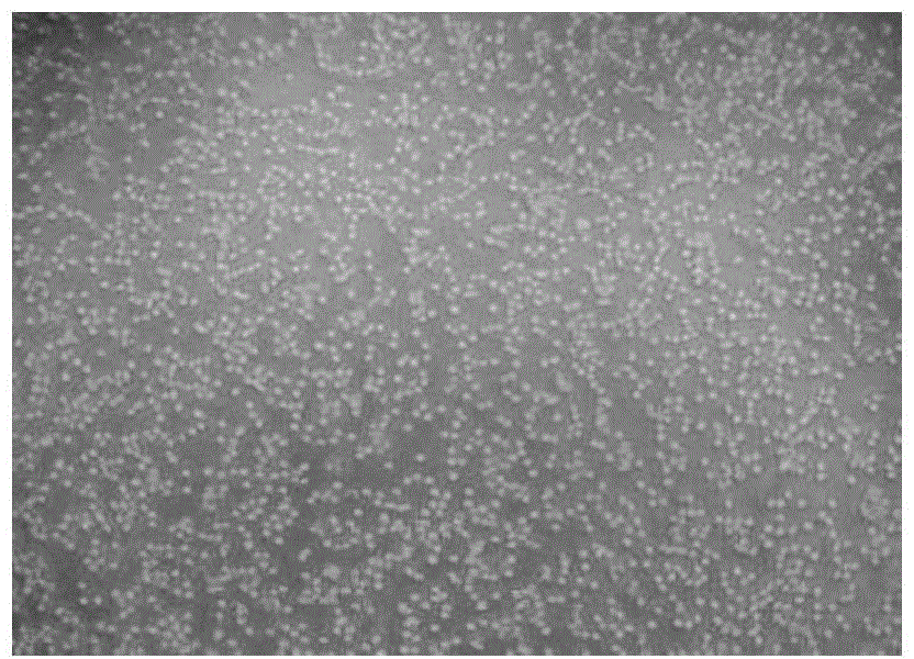 An animal cell culture medium, a preparing method thereof and applications of the culture medium