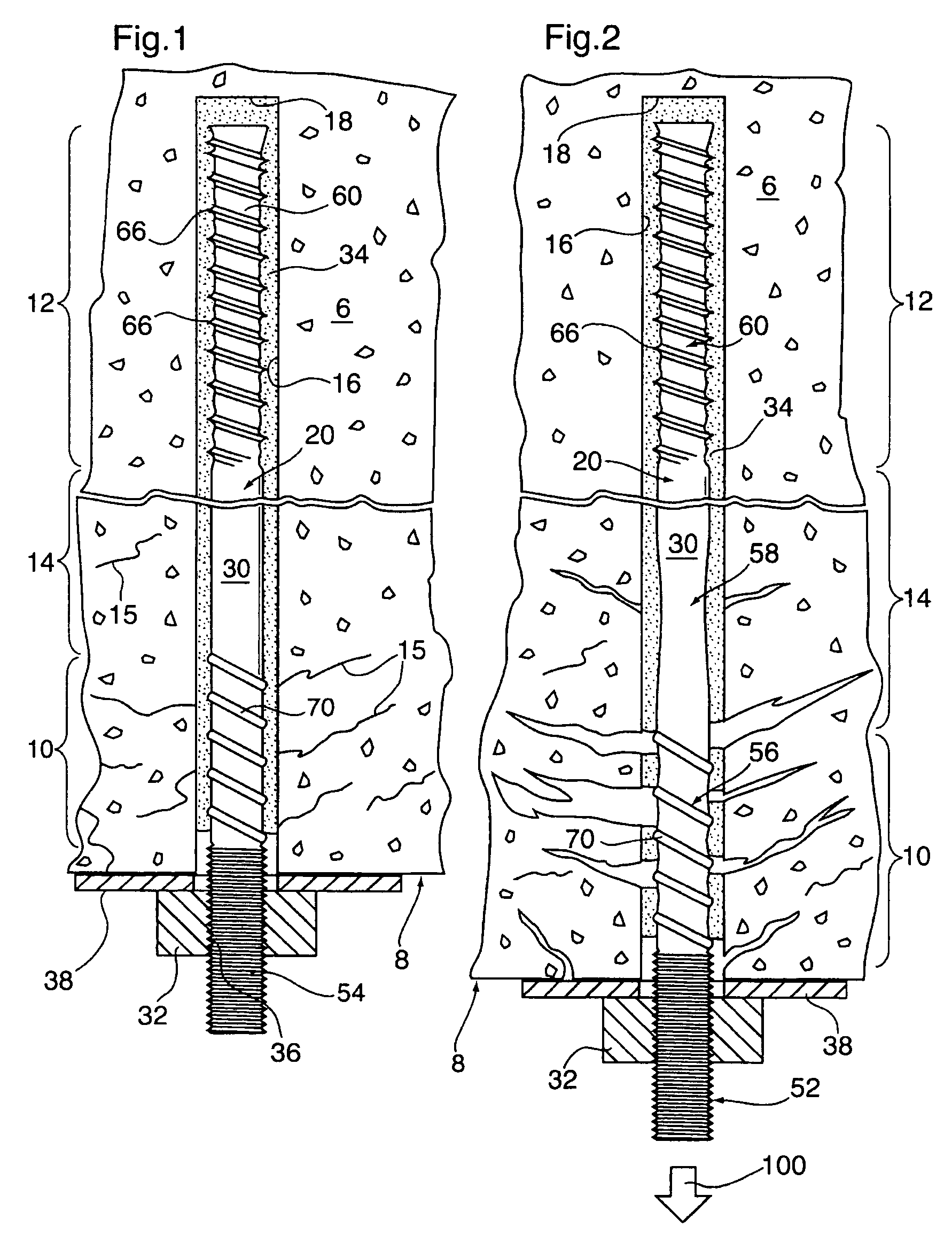 Anchor tendon with selectively deformable portions