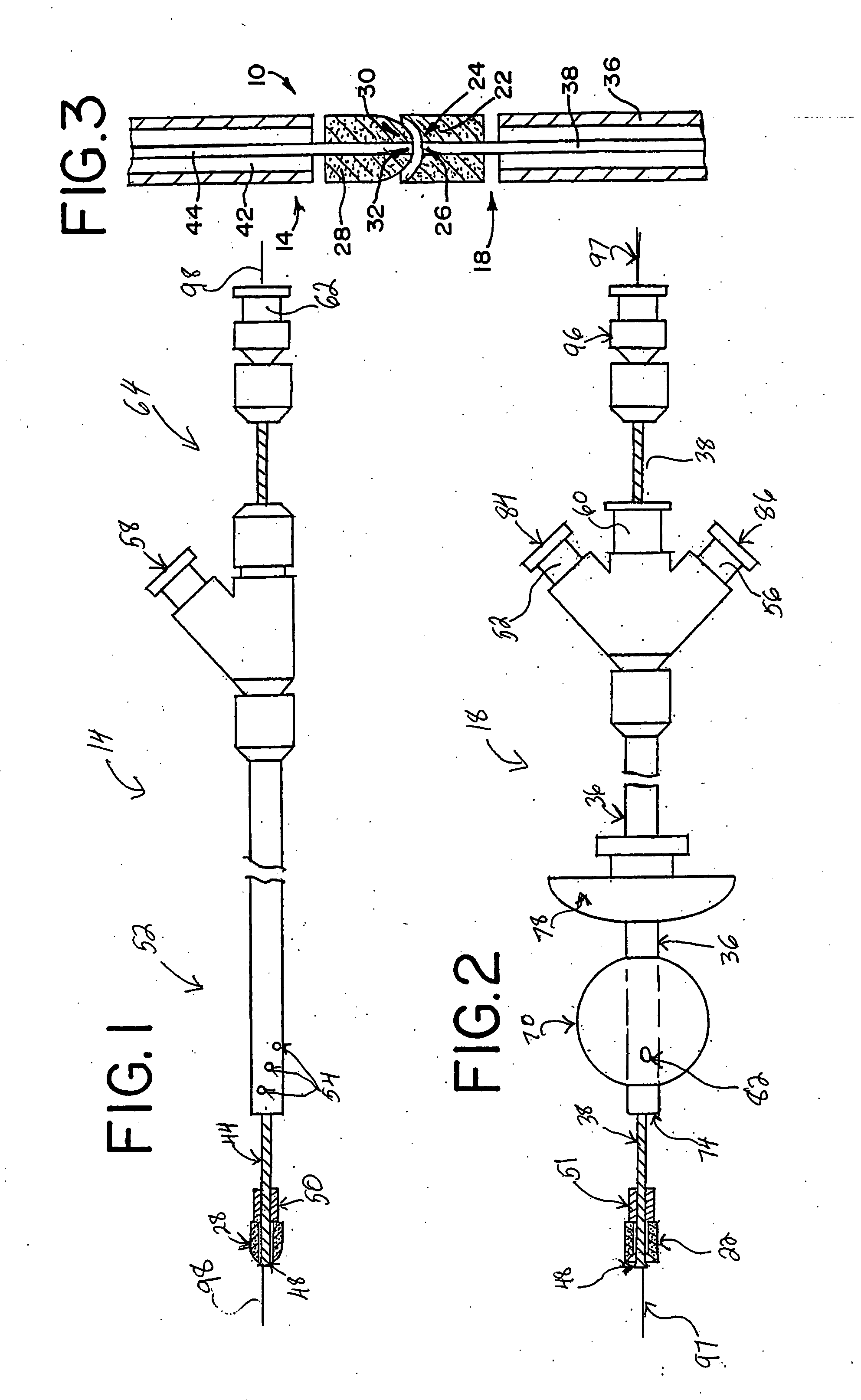 Pediatric atresia magnets