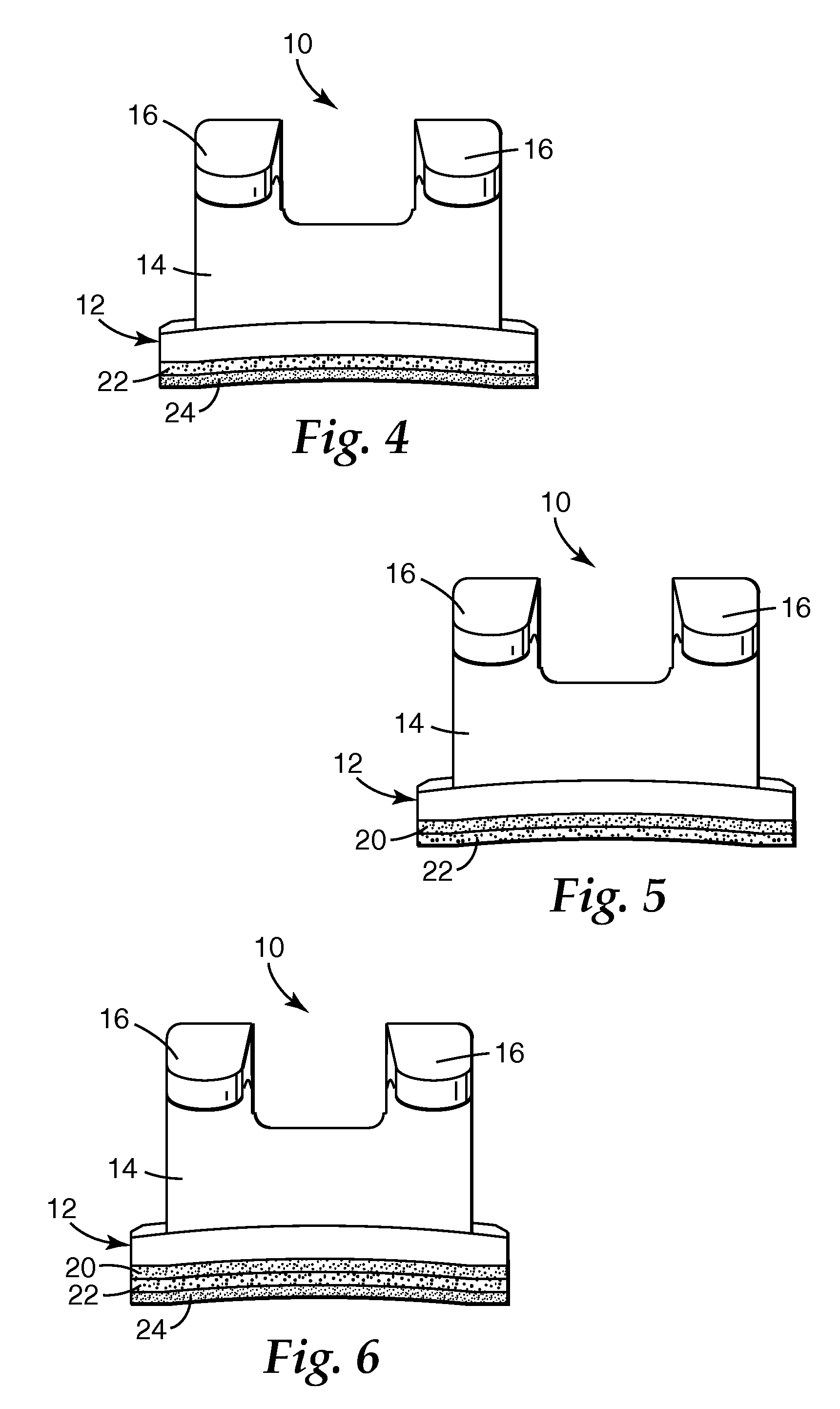 Methods for reducing bond strengths, dental compositions, and the use thereof