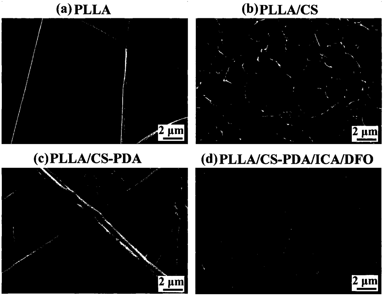 Polylactic-acid-based bone tissue support loading icariin and deferoxamine and preparation method and application of polylactic-acid-based bone tissue support