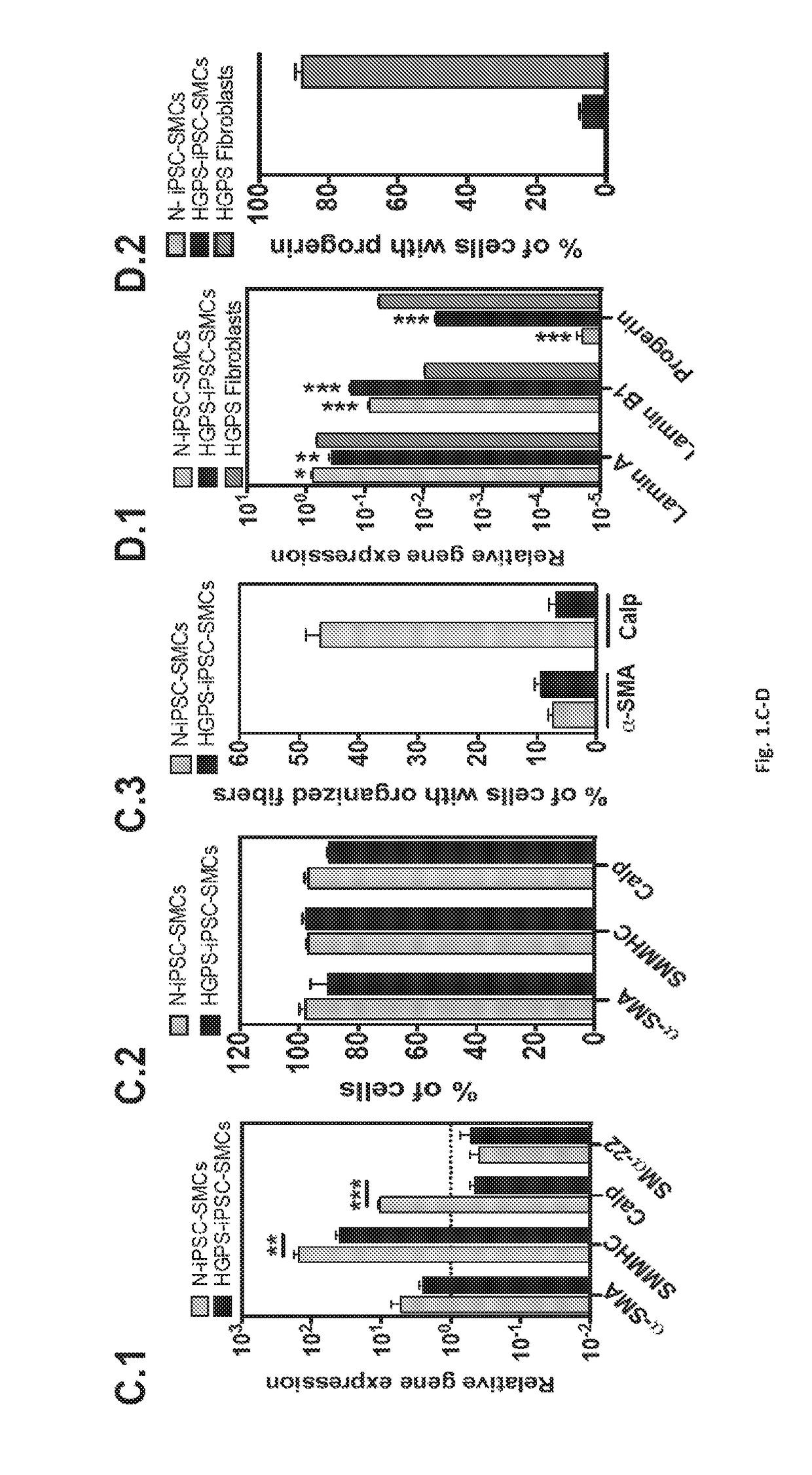 Treatment of hutchinson-gilford progeria syndrome and diseases related to vascular ageing