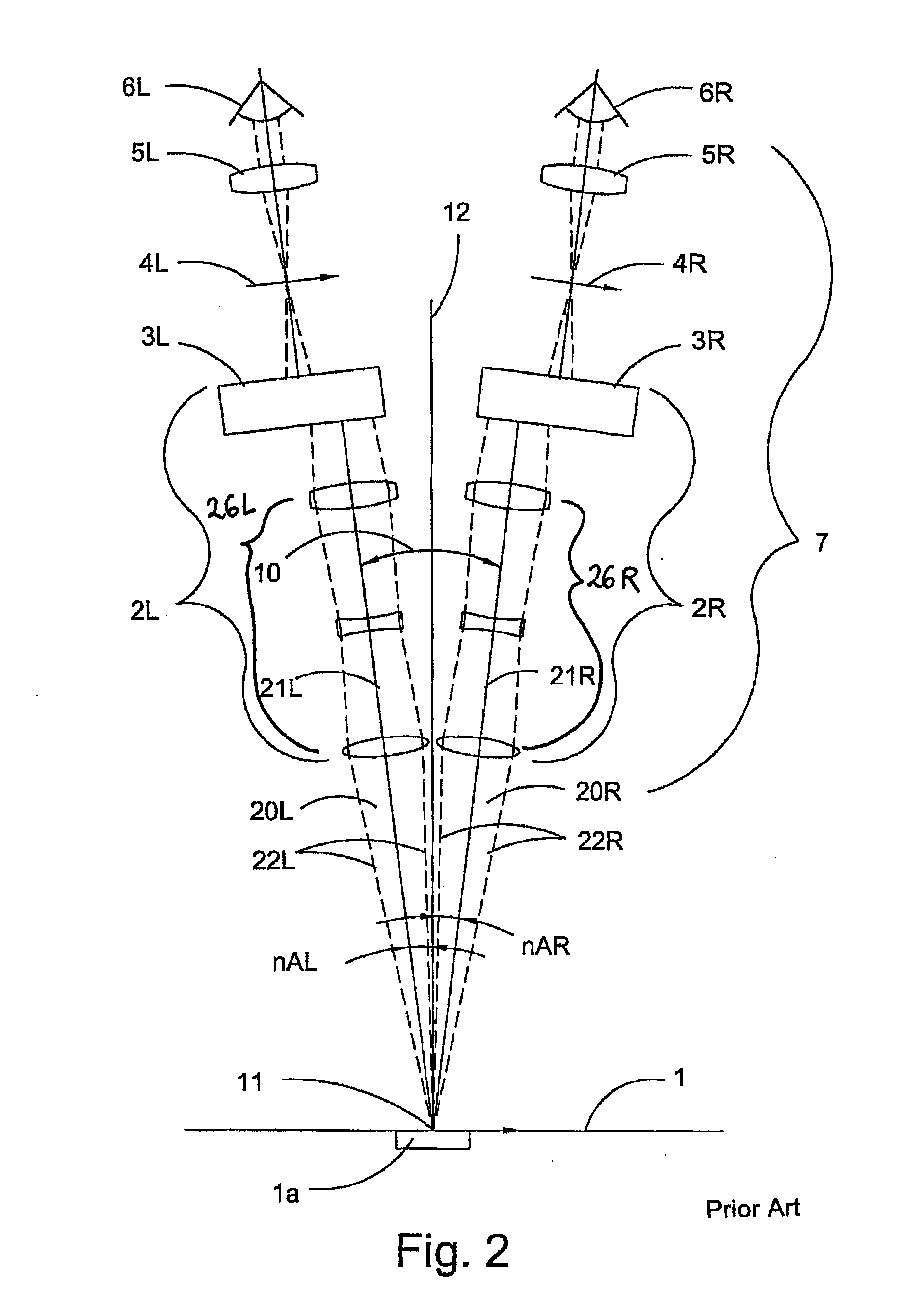 Greenough-type stereomicroscope