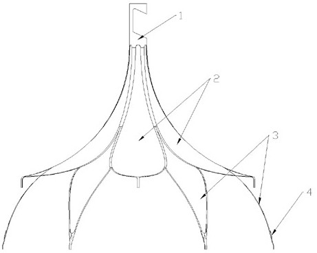 A lotus petal-type double-layer point-supported retrievable vena cava filter and its manufacturing method