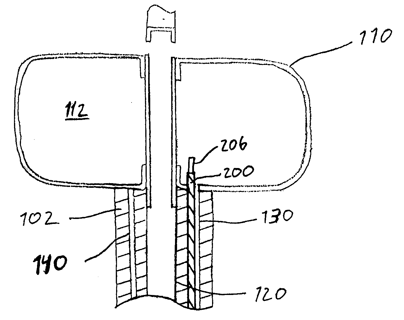 Illuminating balloon catheter and method for using the catheter