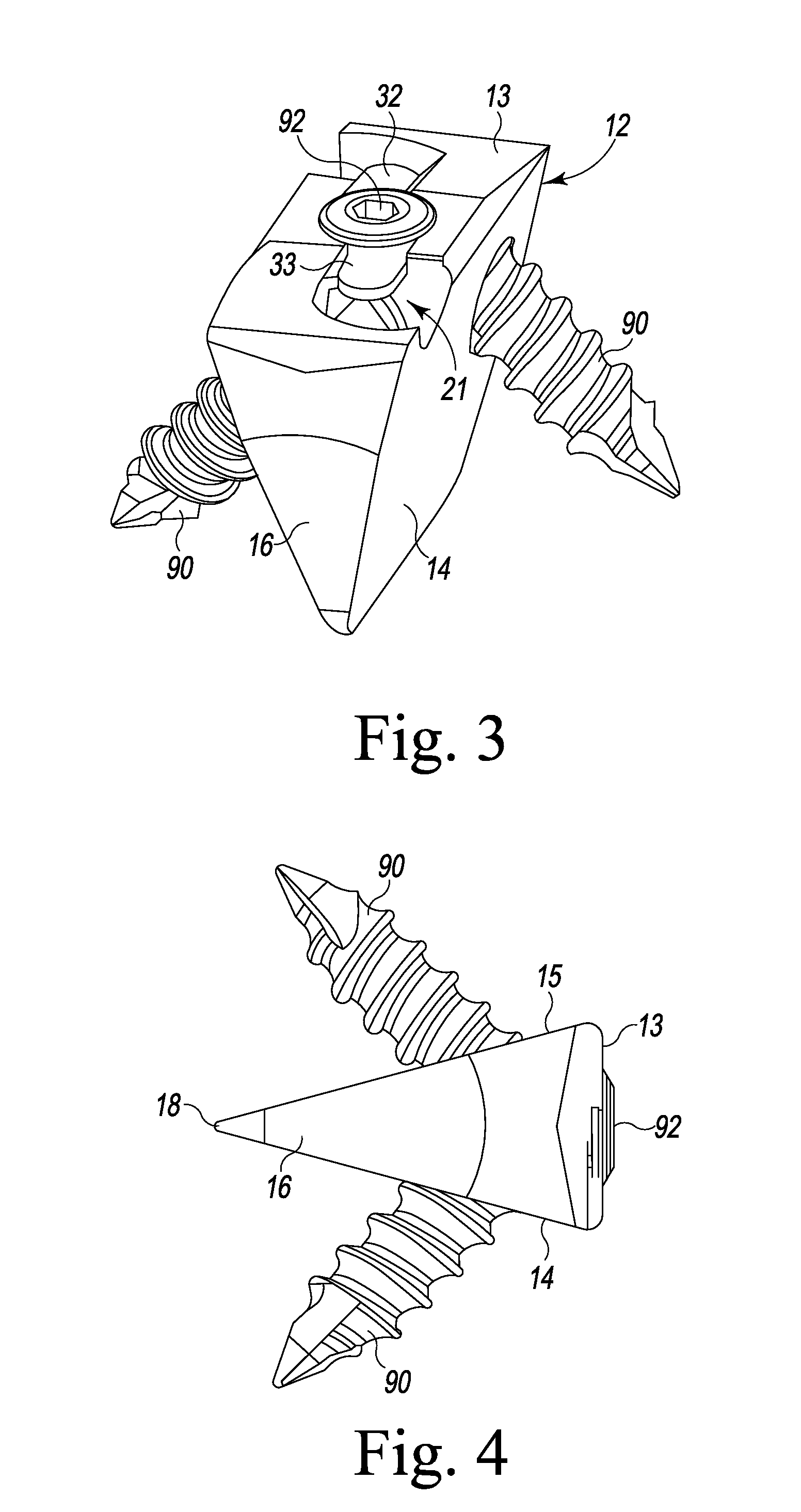 Foot Implant For Bone Fixation