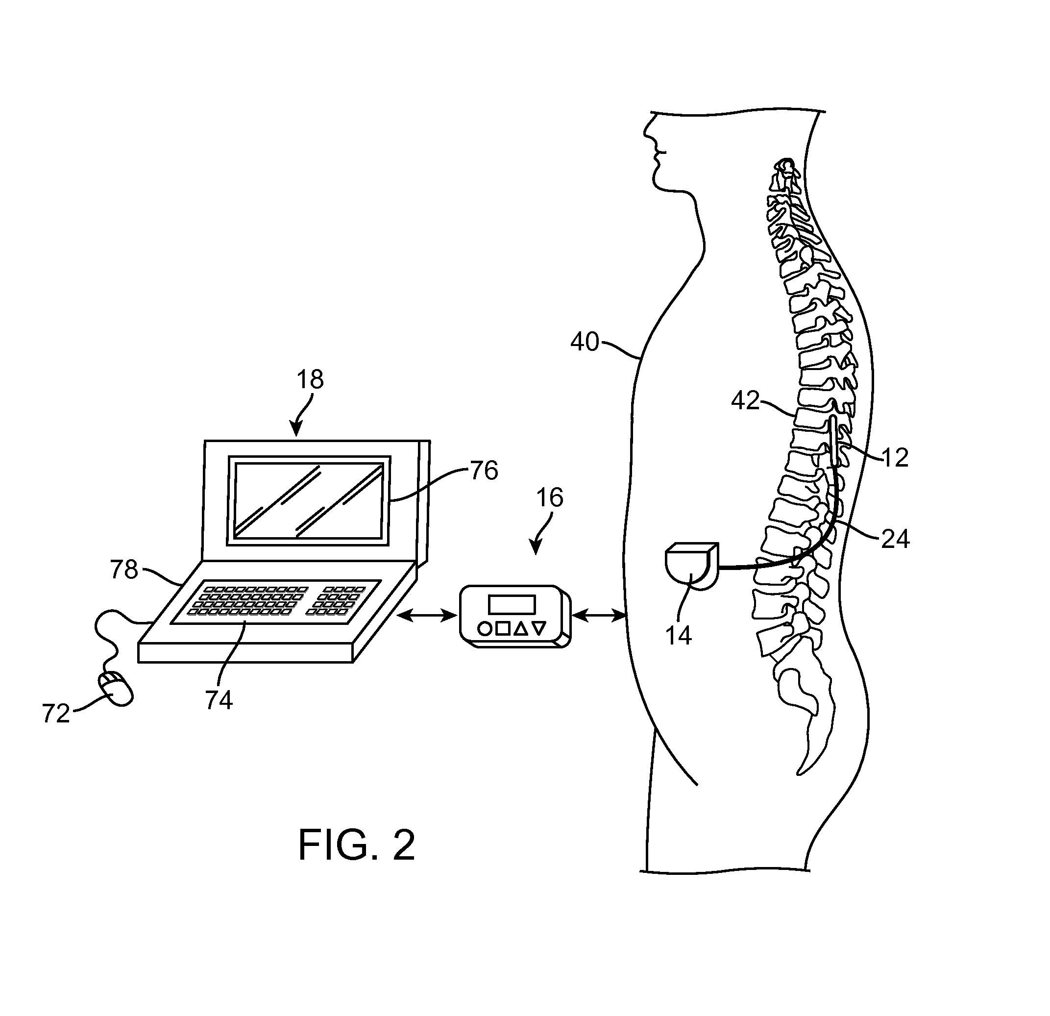 Neurostimulation system and method with graphically manipulatable stimulation target