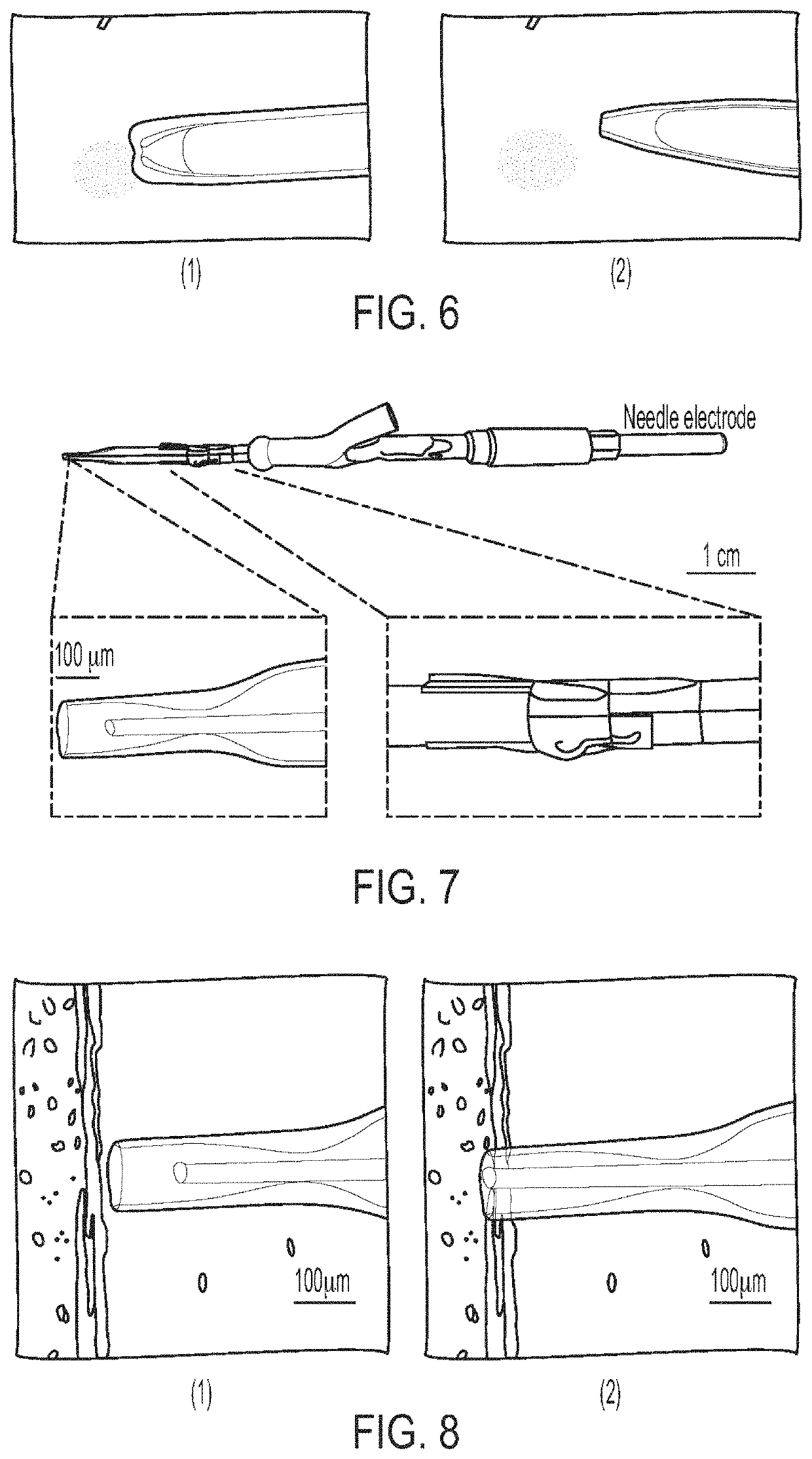 Bubble-jetting member, gas-liquid jetting member, localized ablation device, and localized injection device