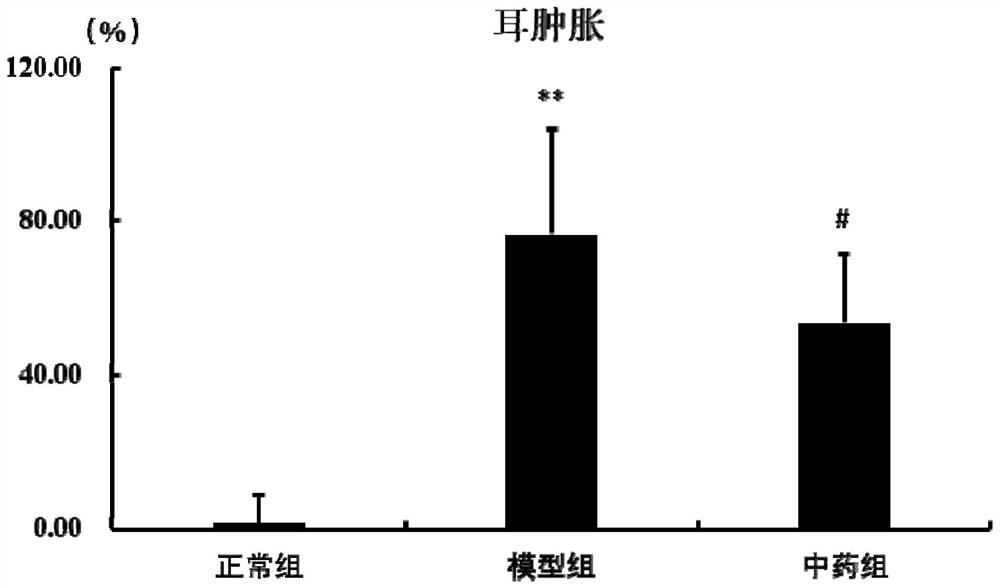 Traditional Chinese medicine compound composition for treating refractory gastroesophageal reflux