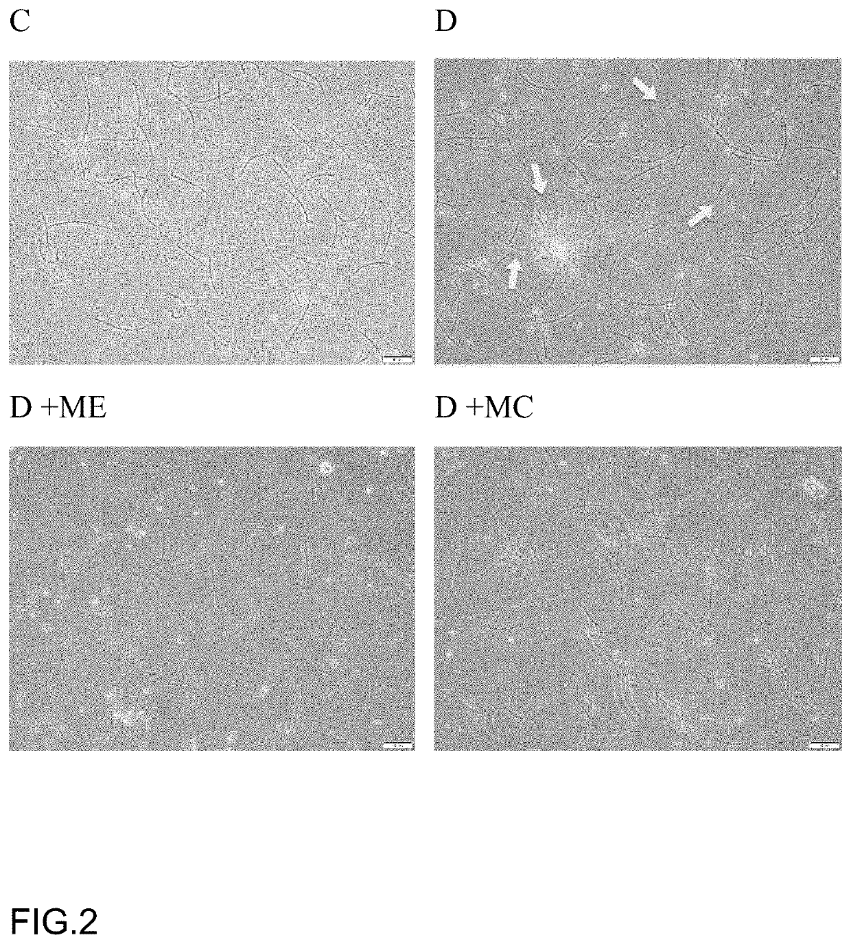 Active substance of <i>Morchella</i>, its use and a composition thereof for improving the reproductive function