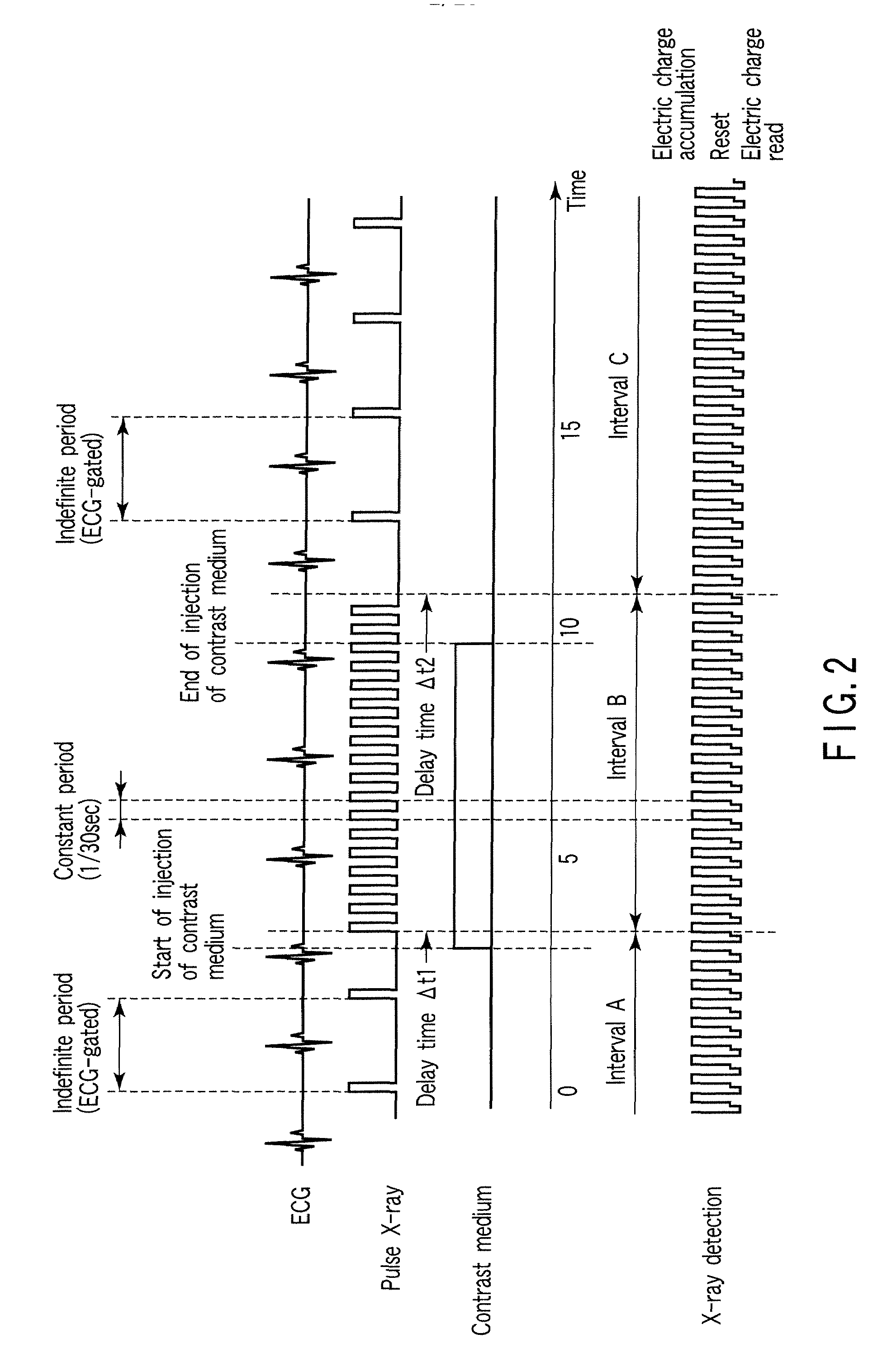 X-ray diagnostic apparatus and image processing apparatus