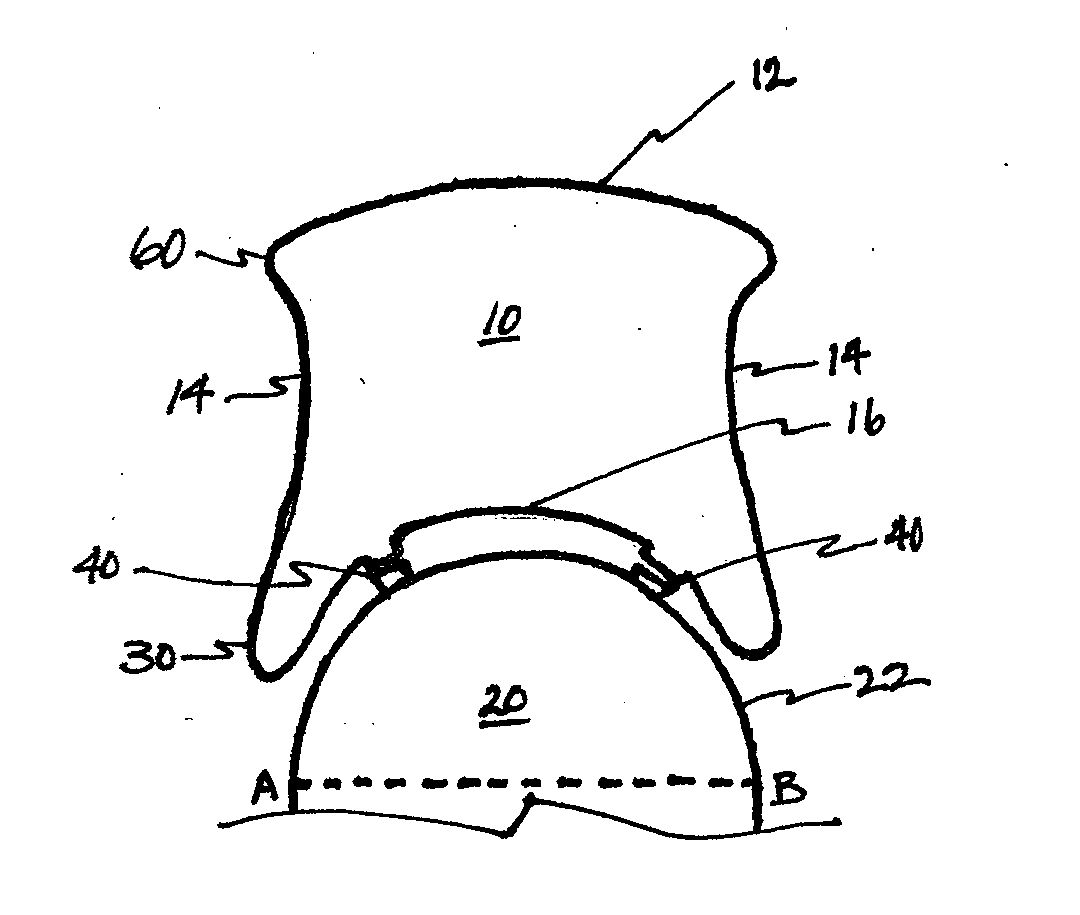 Vitreous Compressing Plate Haptic