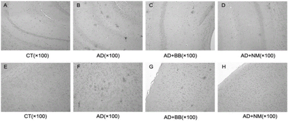 Composition for improving Alzheimer's disease cognition impairment