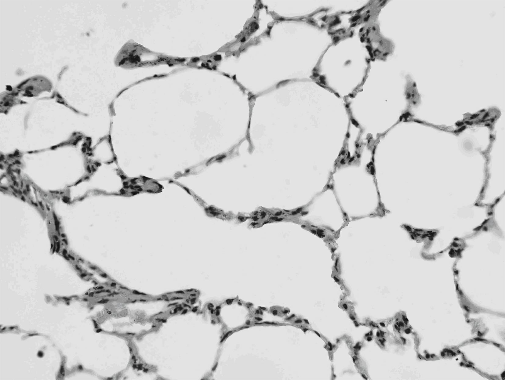 Chinese medicine combination for preventing and curing lung injury and pulmonary fibrosis and preparation method thereof