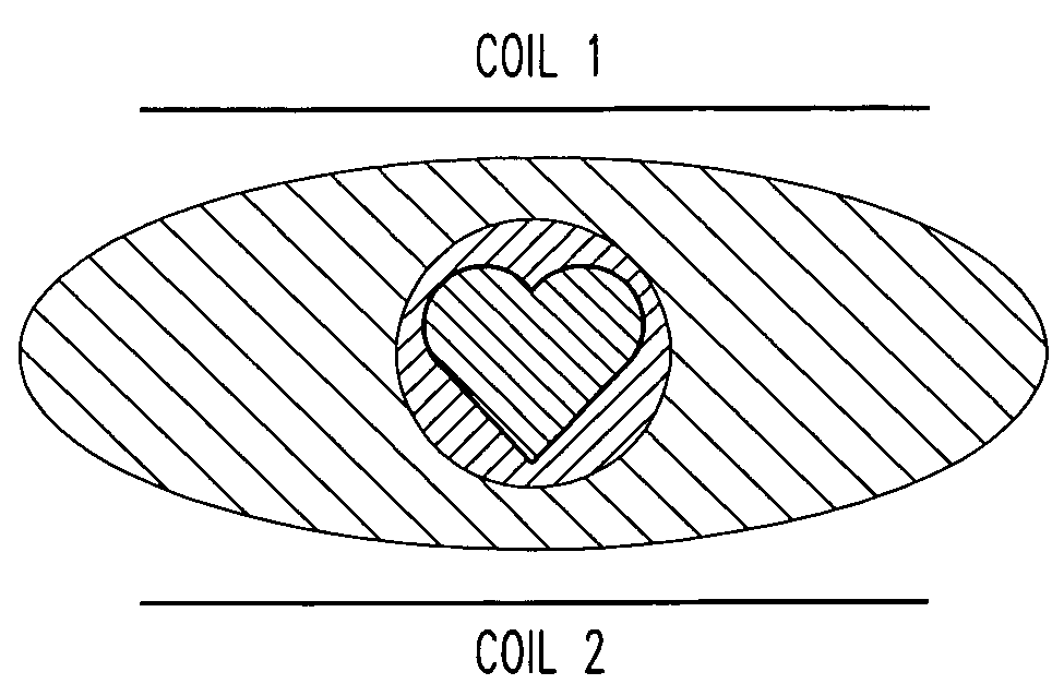 Magnetic resonance imager using cylindrical offset region of excitation, and method