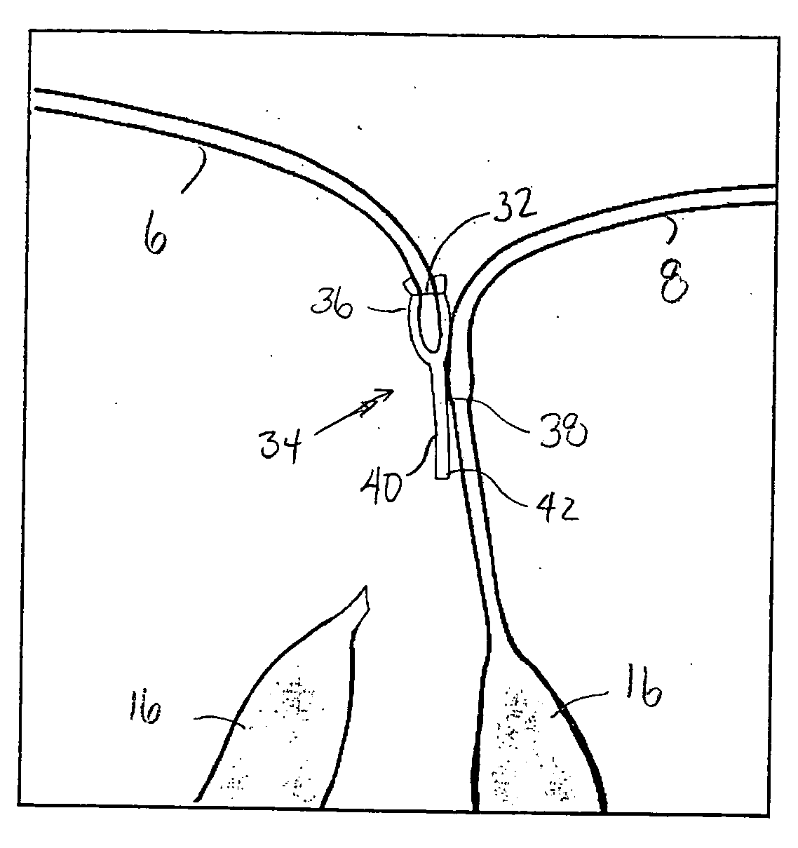 Devices and methods for repairing cardiac valves