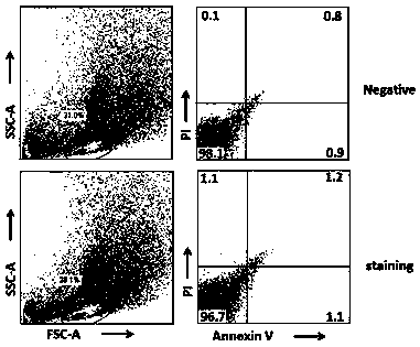 Mouse pancreas infiltrated immune cell separation method