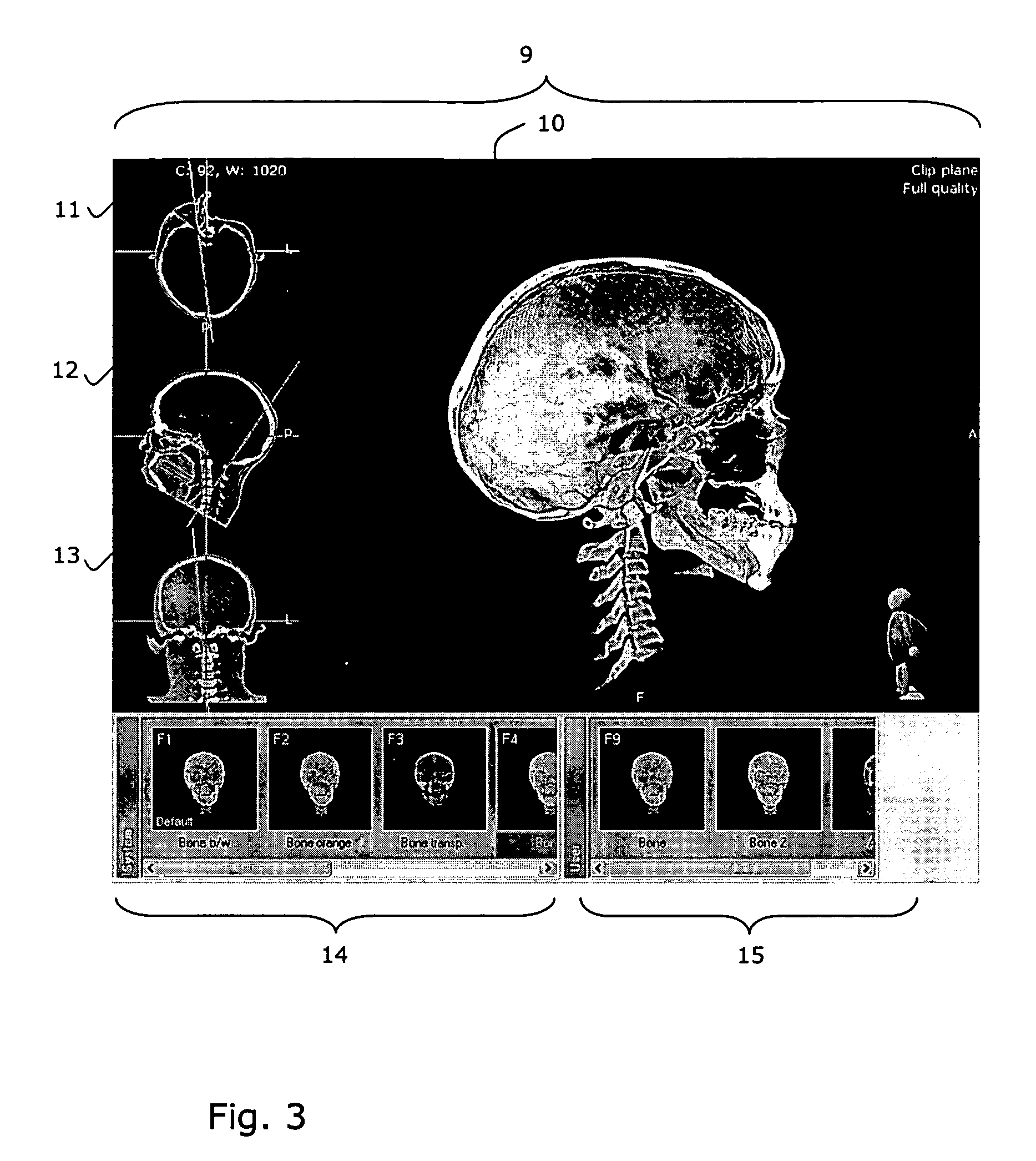 Computer program product and method for analysis of medical image data in a medical imaging system