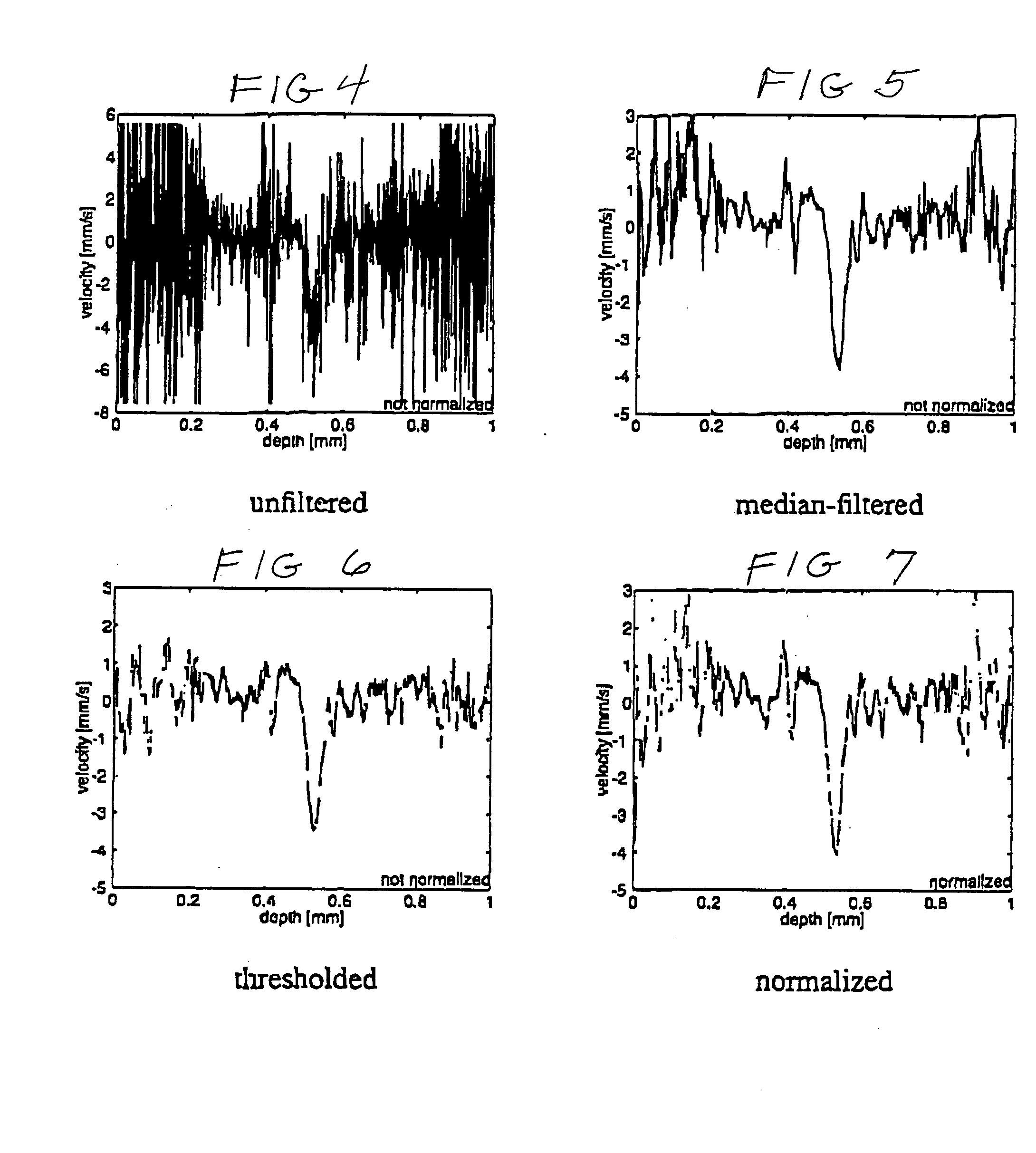 Signal processing using non-linear regression with a sinusoidal model