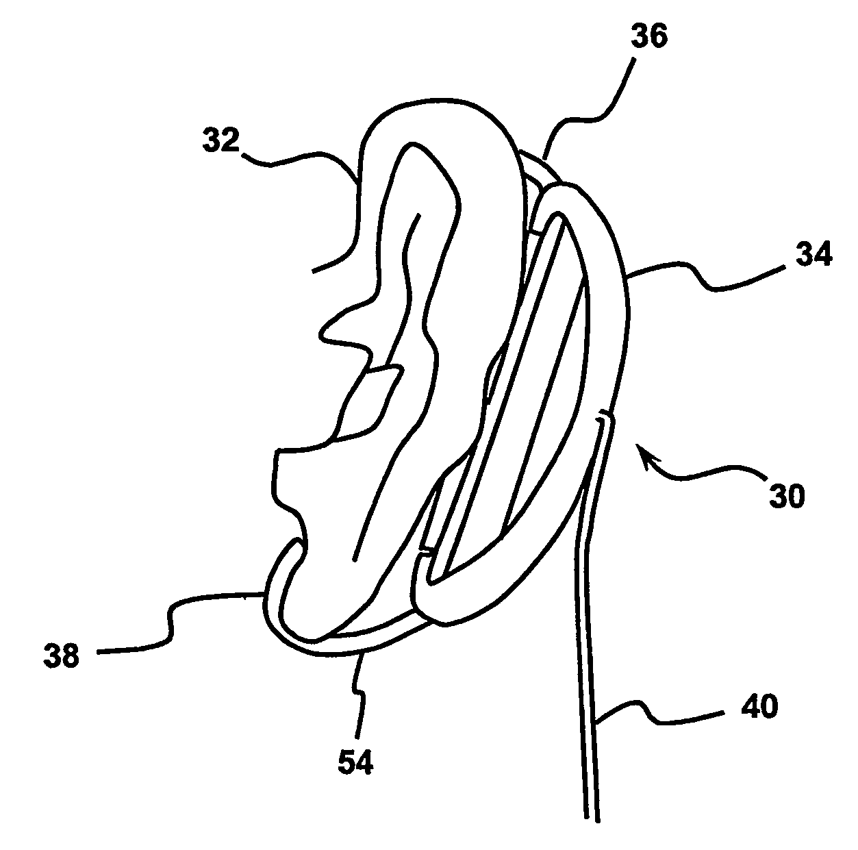 Audio apparatus