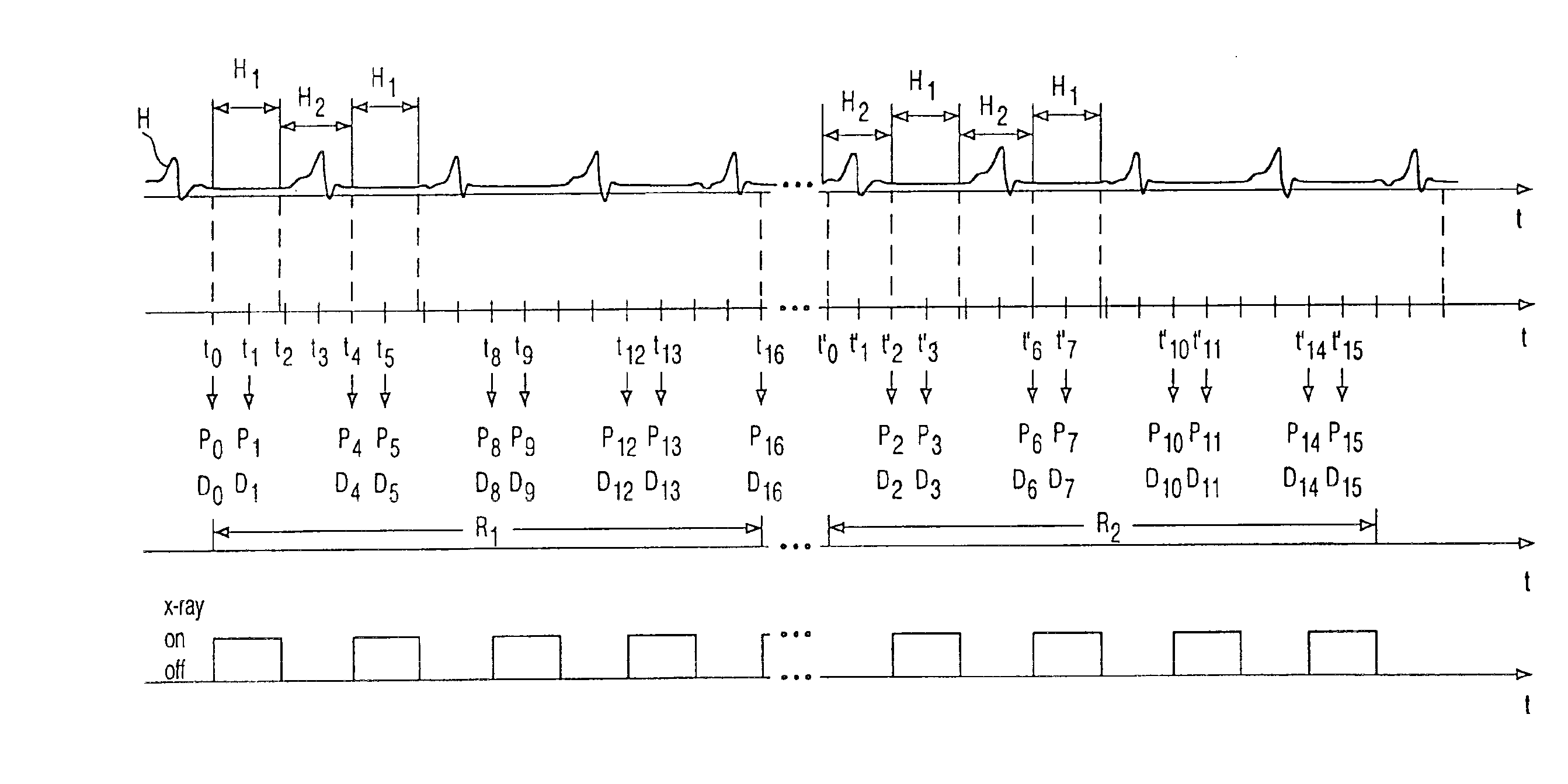 Method and device for acquiring a three-dimensional image data set of a moving organ of the body