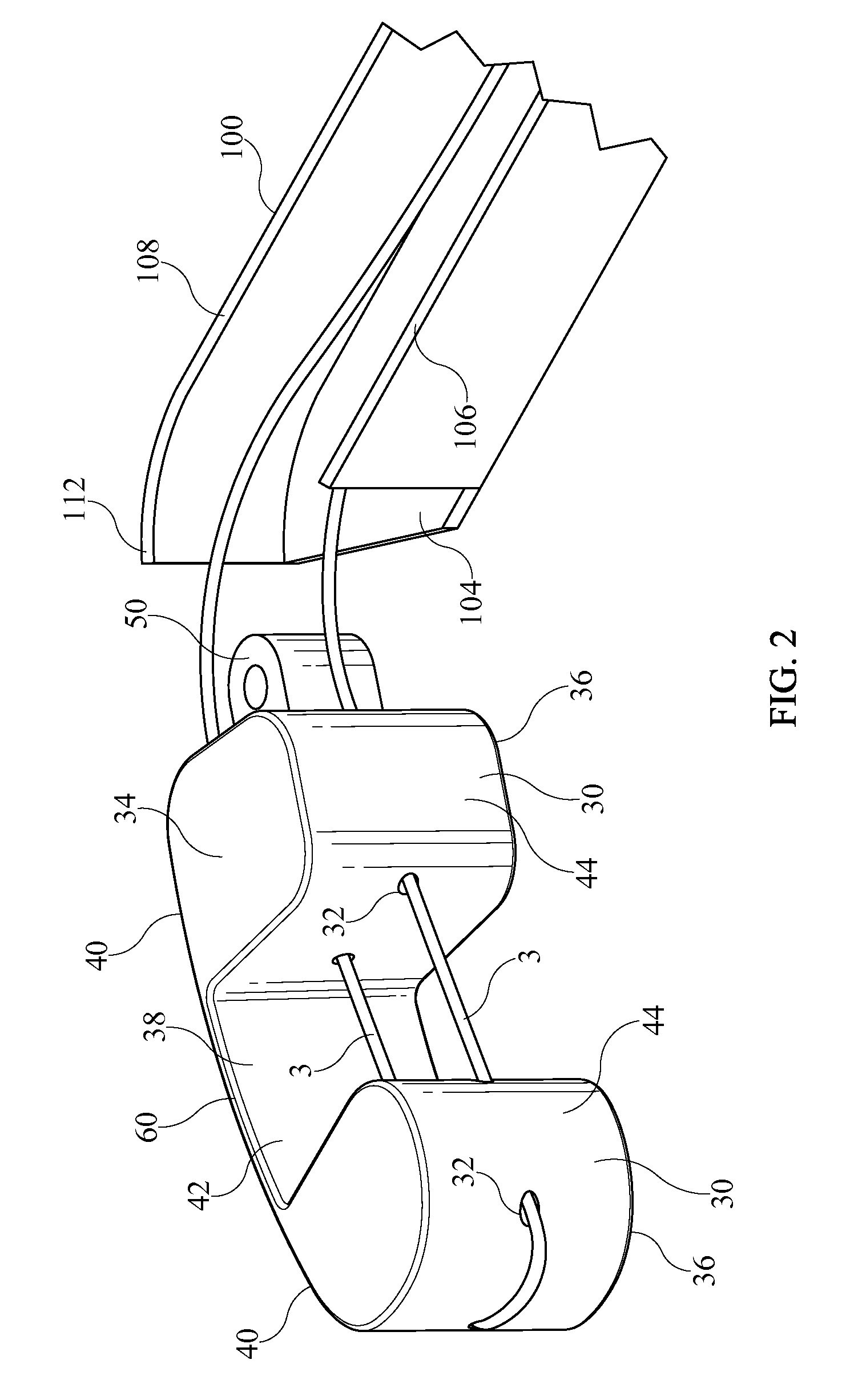 Inter-Body Implantation System and Method