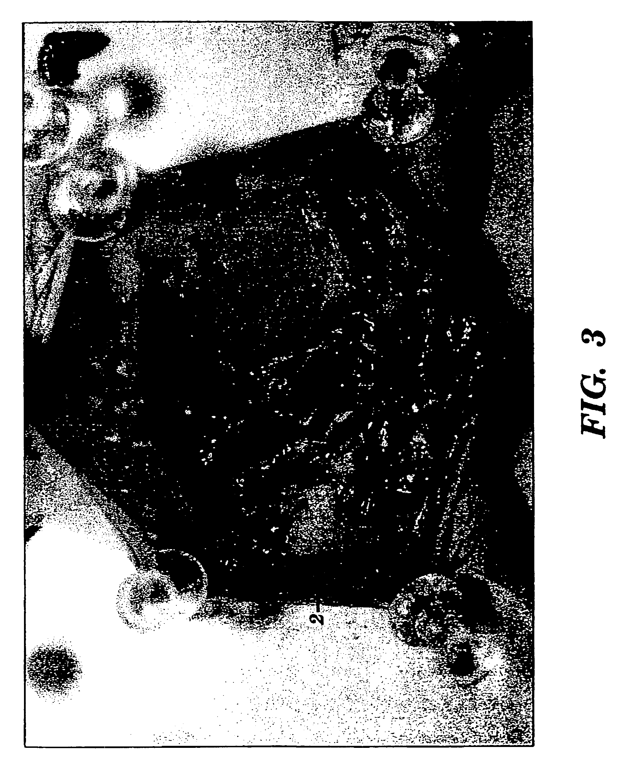 Method and composition for the treatment of cancer