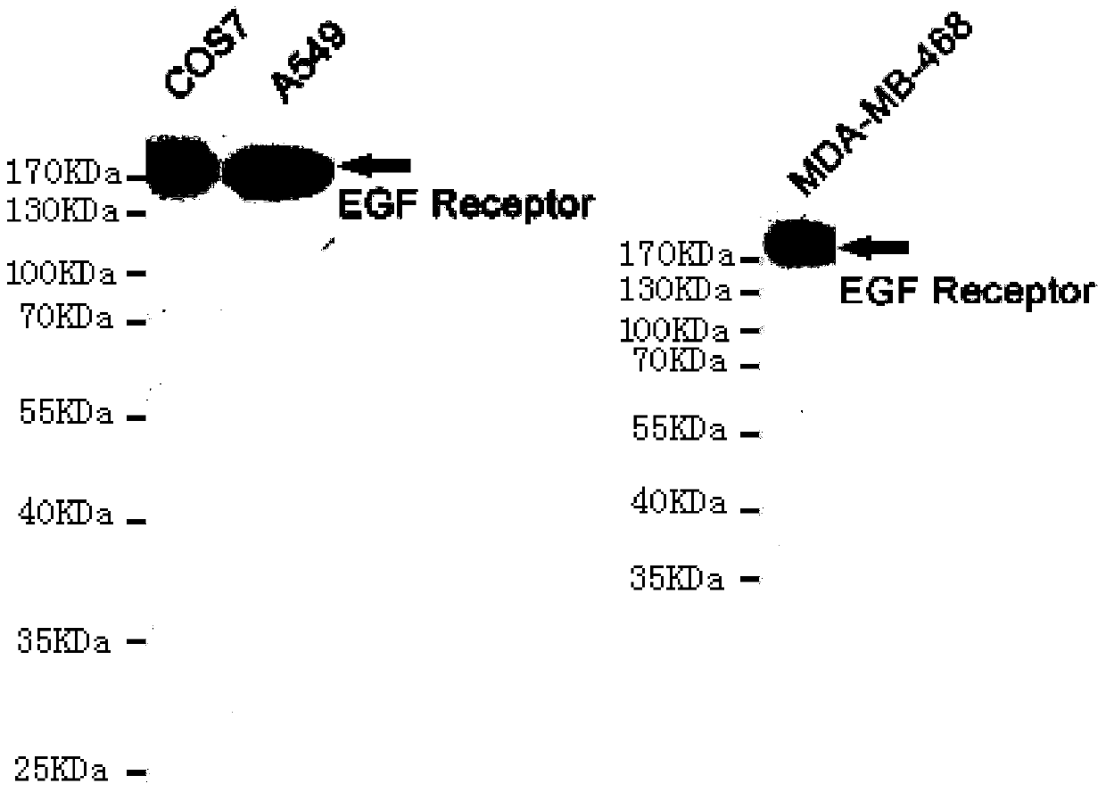 A kind of monoclonal antibody of epidermal growth factor receptor and its application
