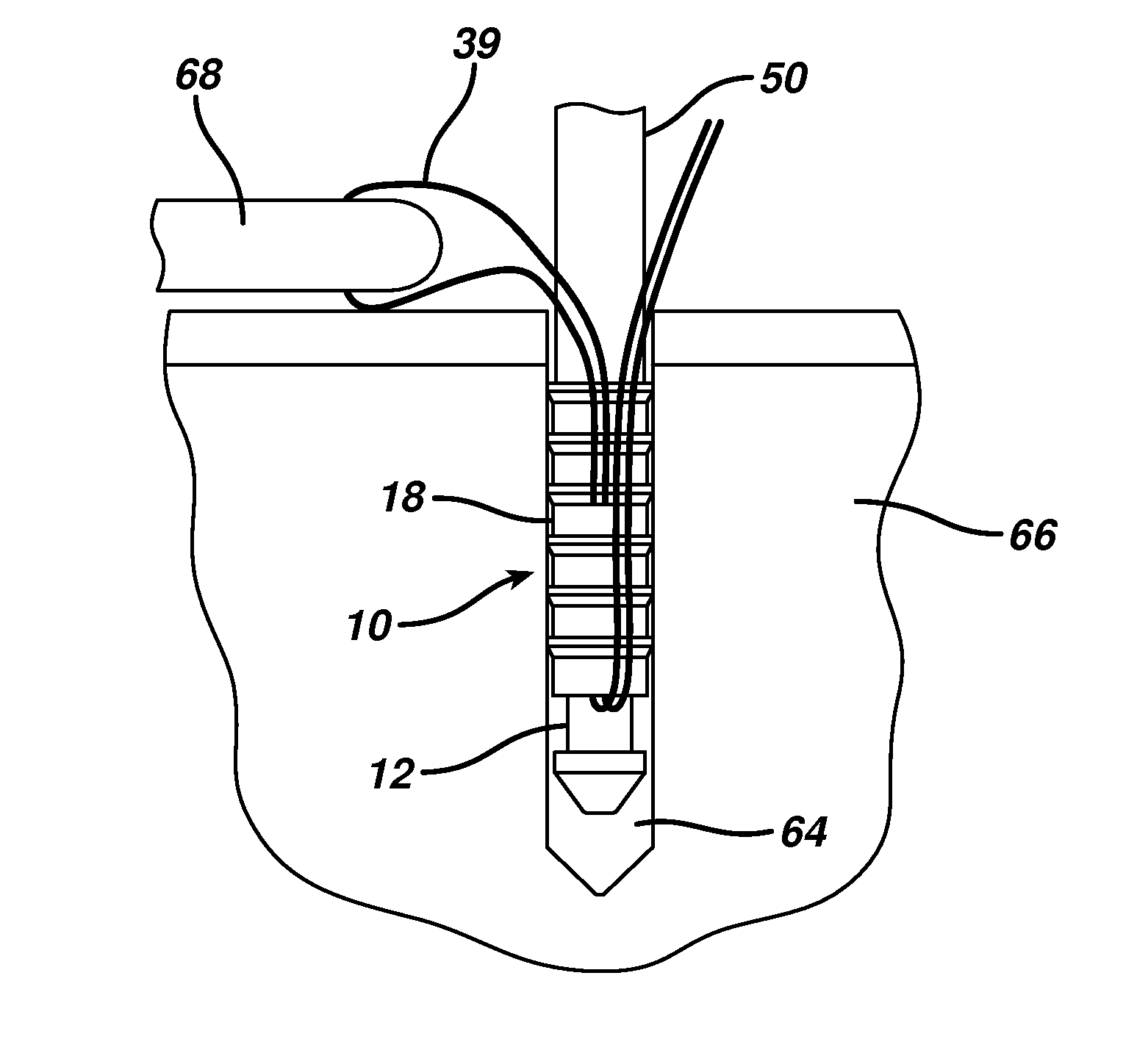 Knotless suture anchor