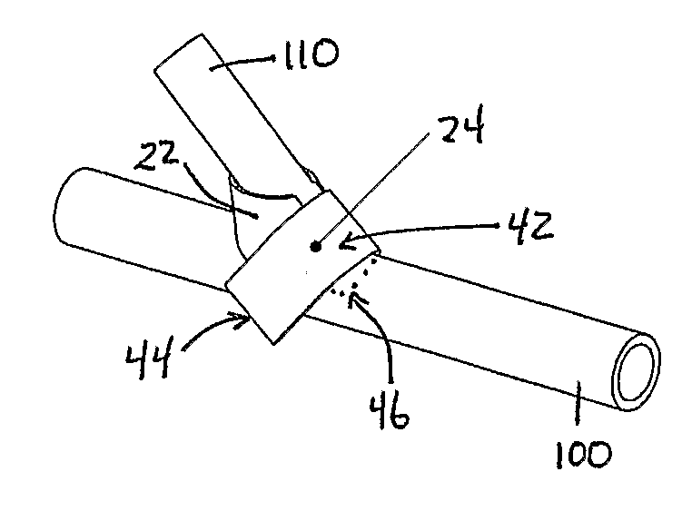 Methods And Compositions For Enhacing Vascular Access