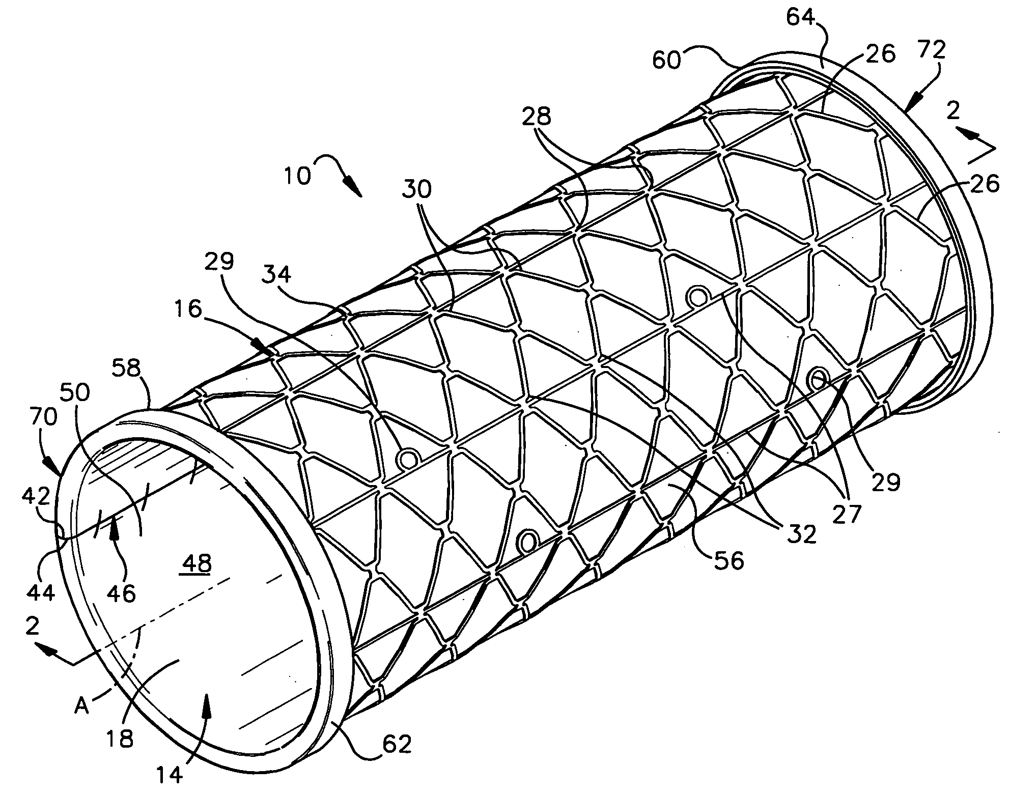 Method for fixing tissue