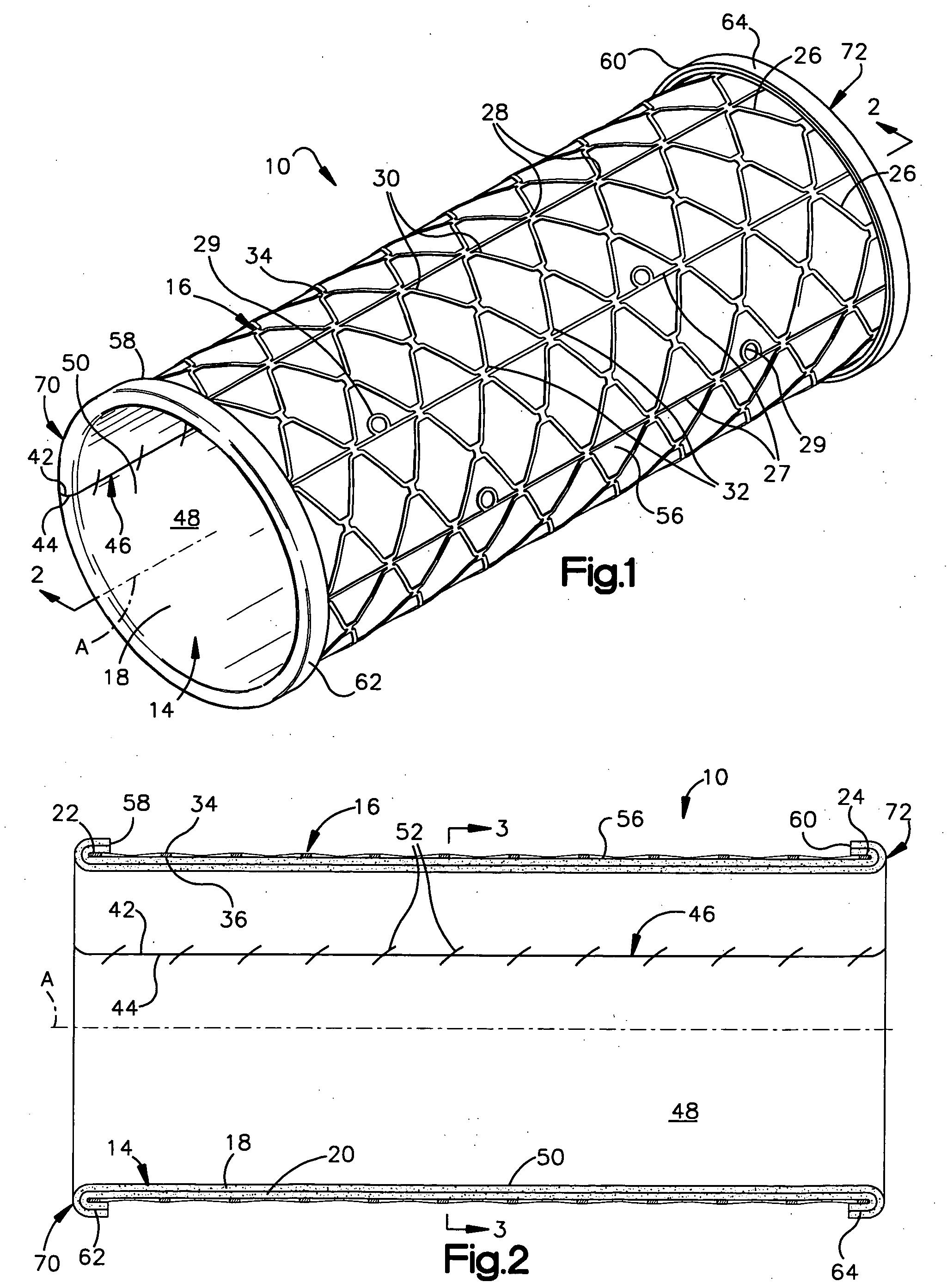 Method for fixing tissue