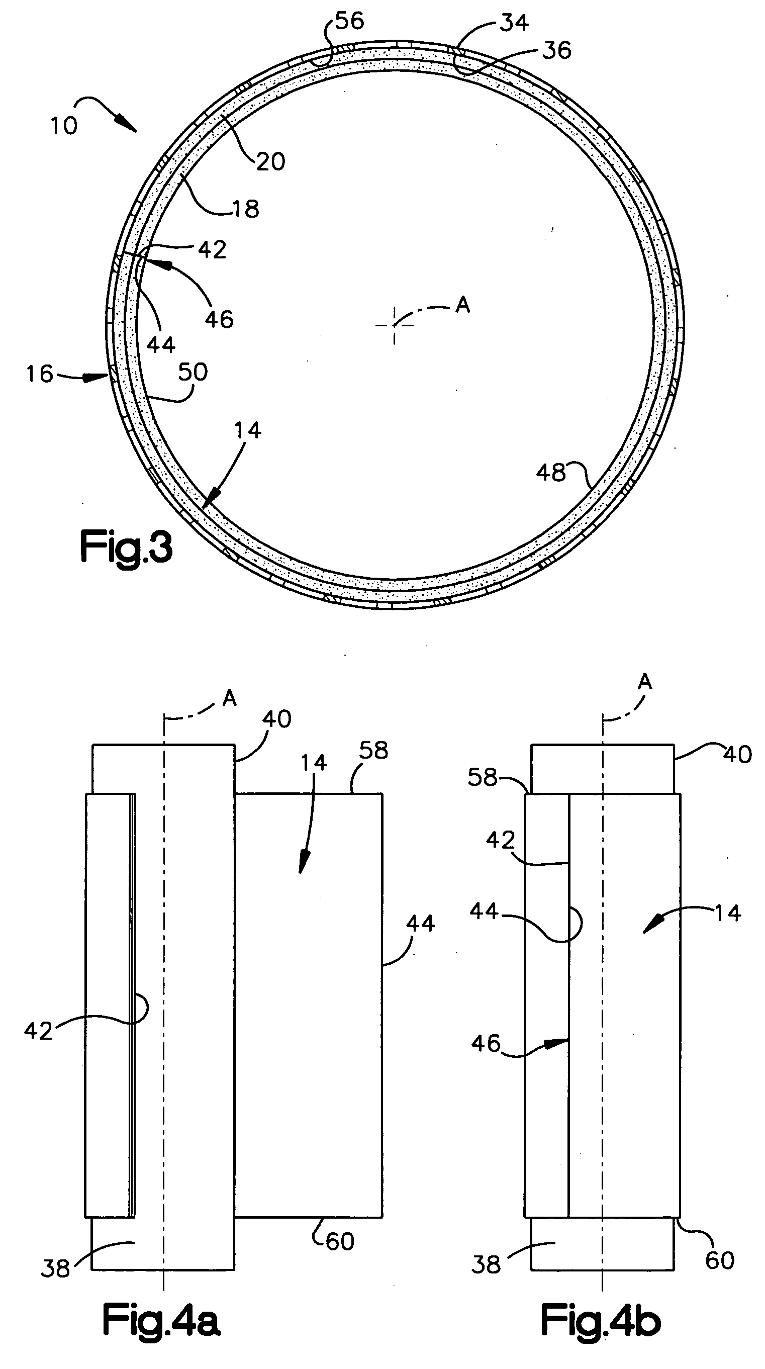 Method for fixing tissue