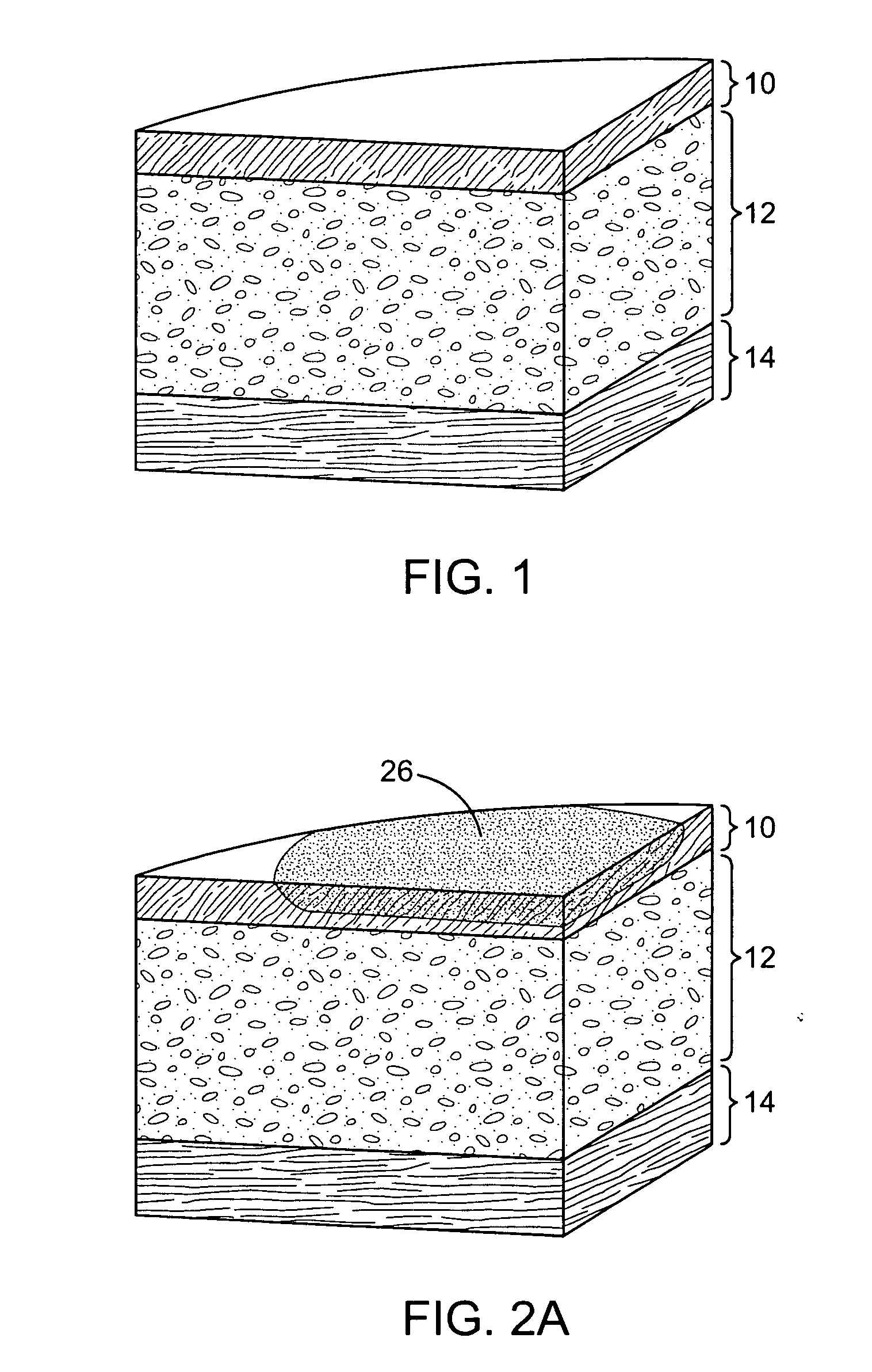 Methods and apparatus for coupling a HIFU transducer to a skin surface