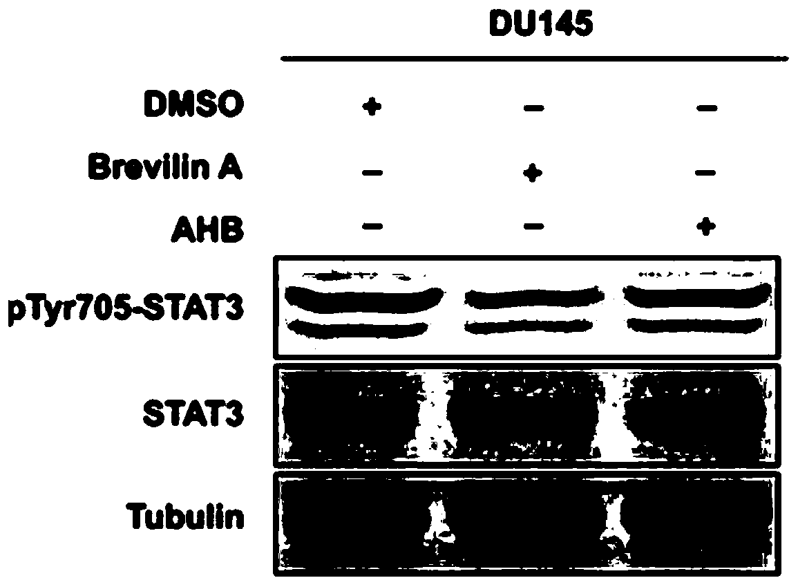 Application and research method of atopaxar hydrobromide as novel JAK-STAT3 signal path inhibitor