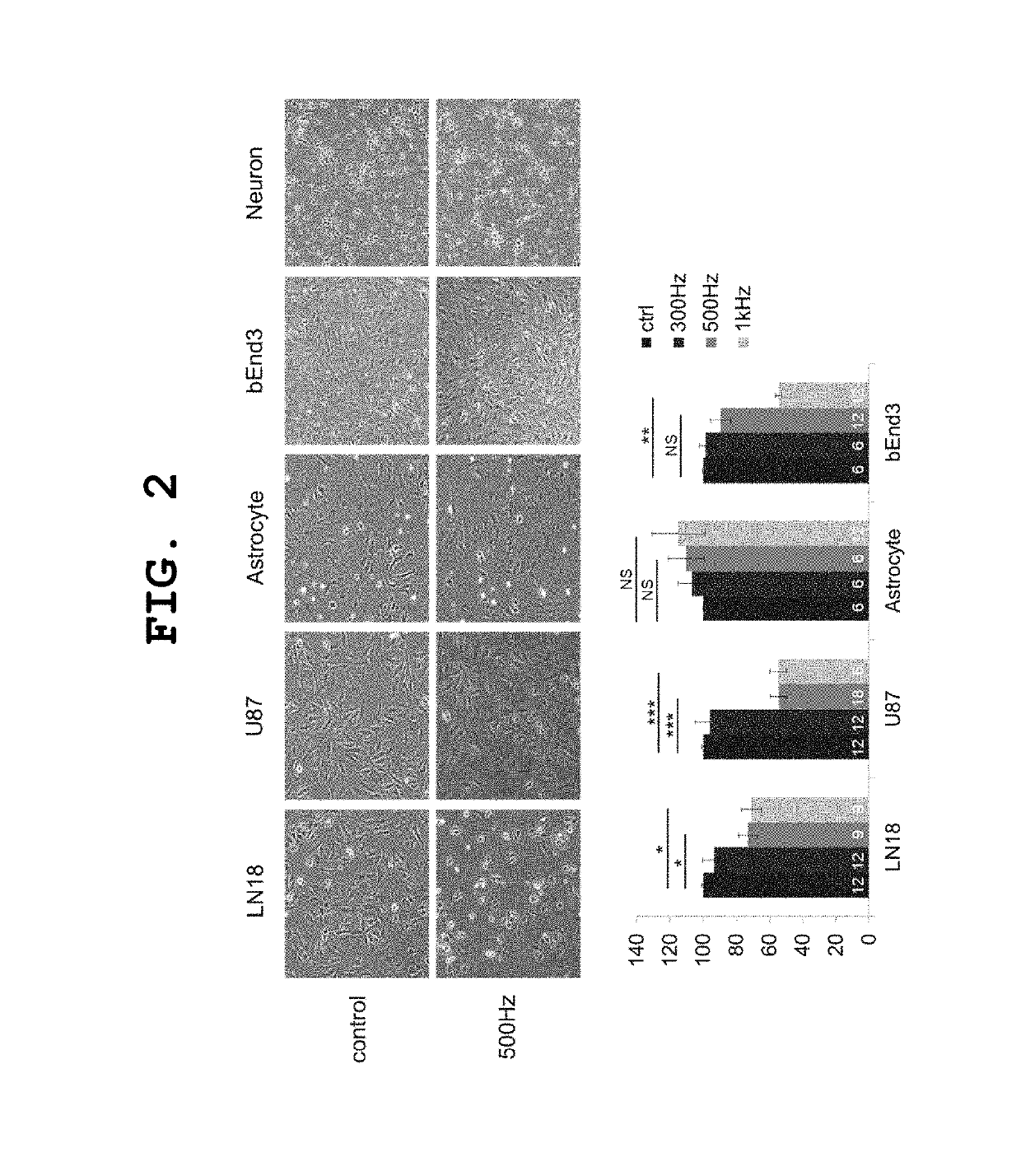 Alternative magnetic stimulating system for preventing or treating brain tumor growth