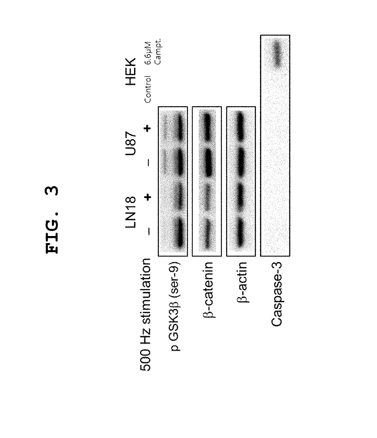 Alternative magnetic stimulating system for preventing or treating brain tumor growth