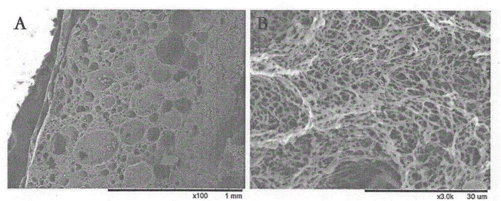 A tissue engineering nanofiber osteochondral repair scaffold and its preparation method