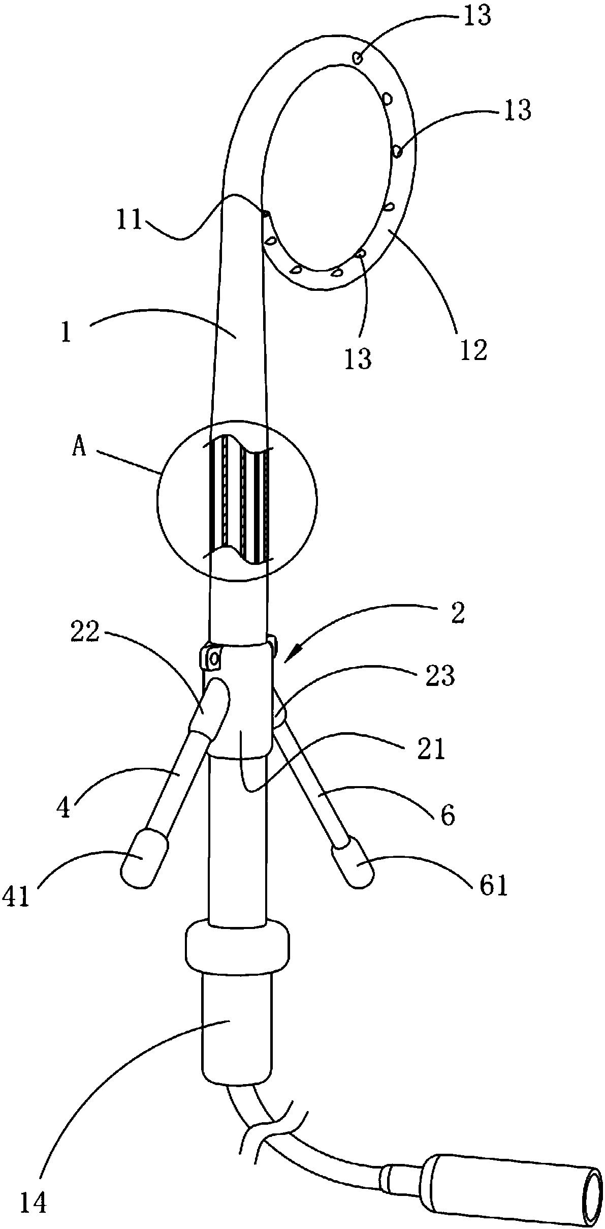 Pigtail-shaped peritoneal double-sleeve drainage catheter