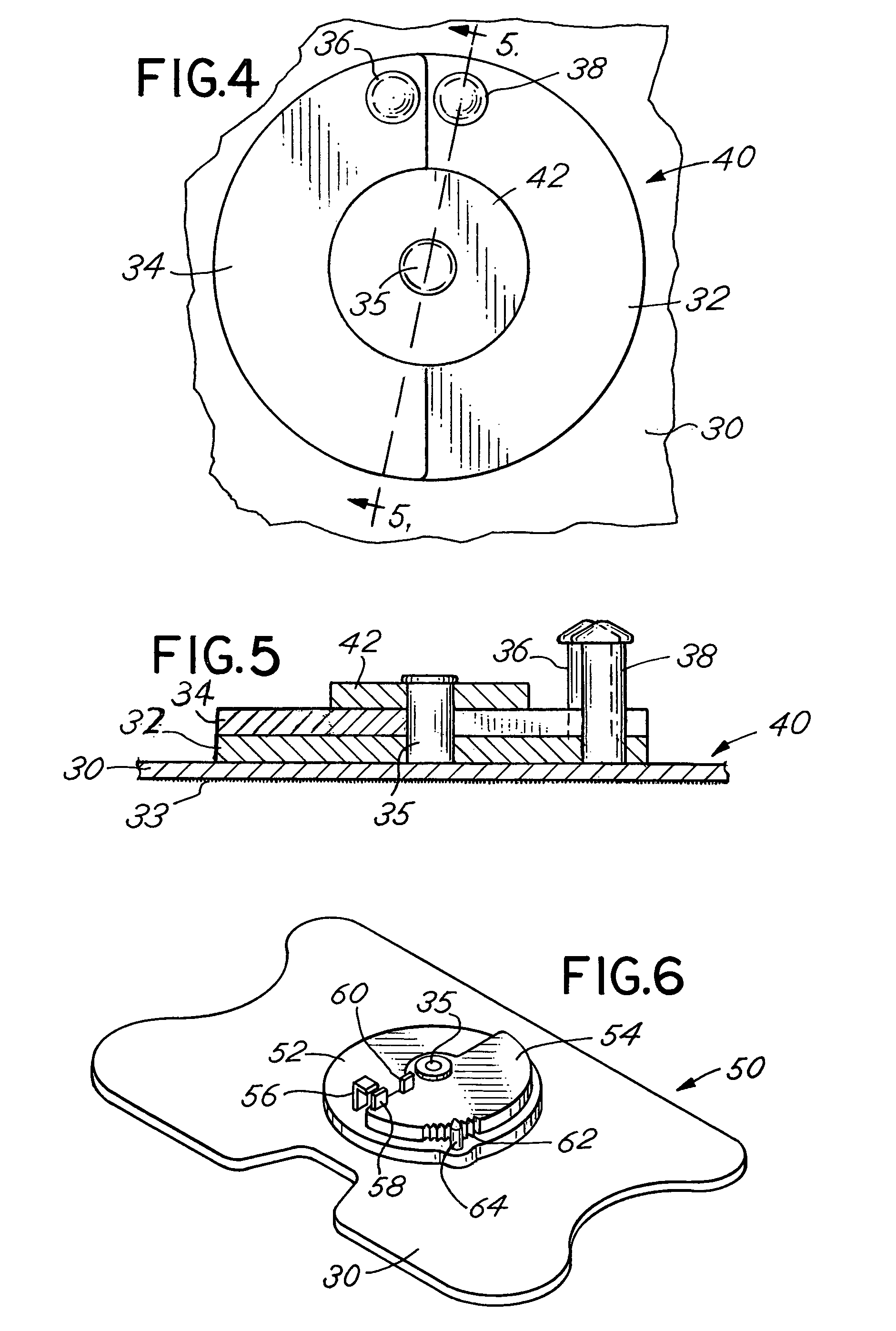 Catheter securement device